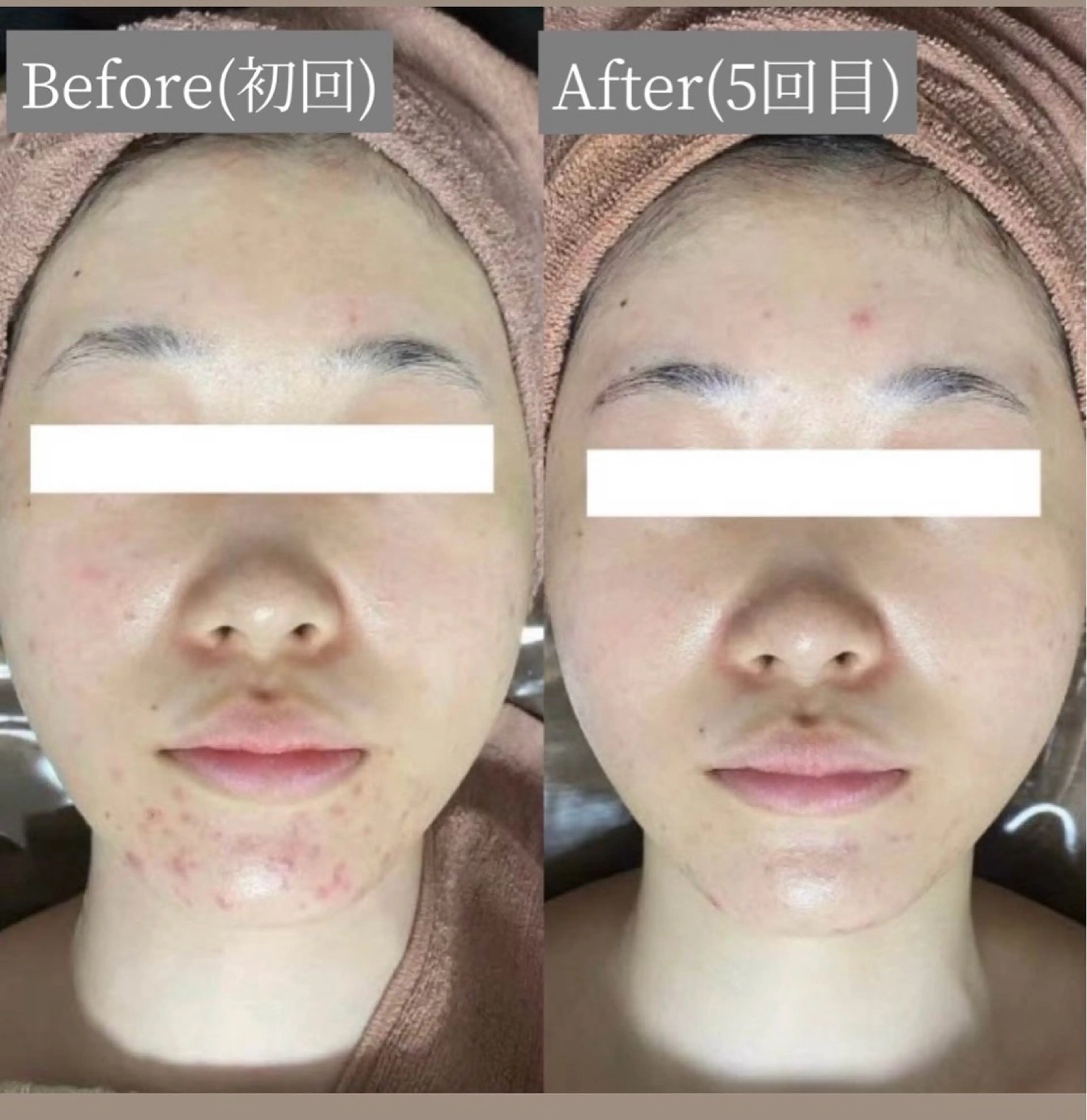 エステ White Aqua京橋店所属・WHITE AQUAのエステ・リラクイメージ