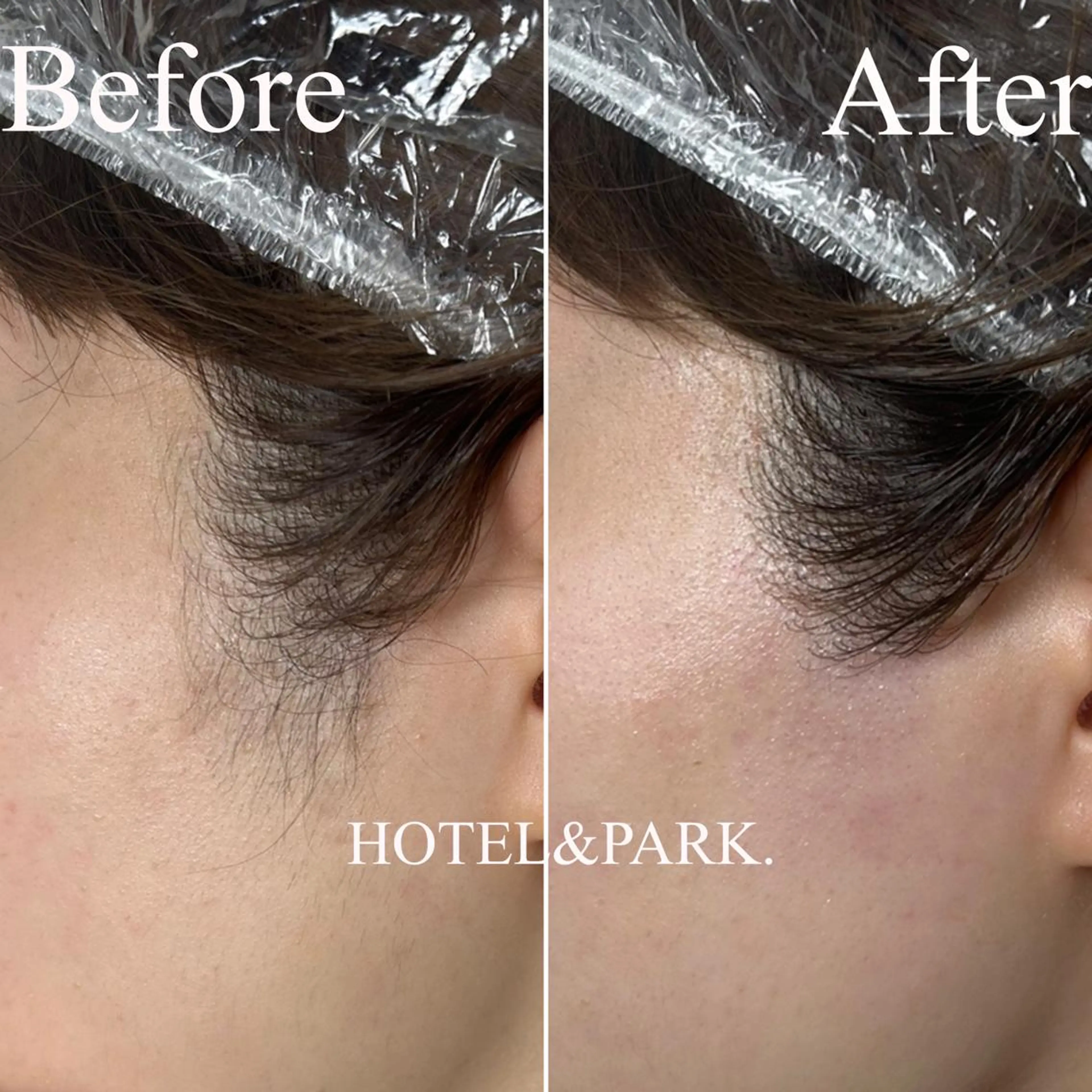 HOTEL&PARK . ワックス脱毛のエステ・リラクイメージ