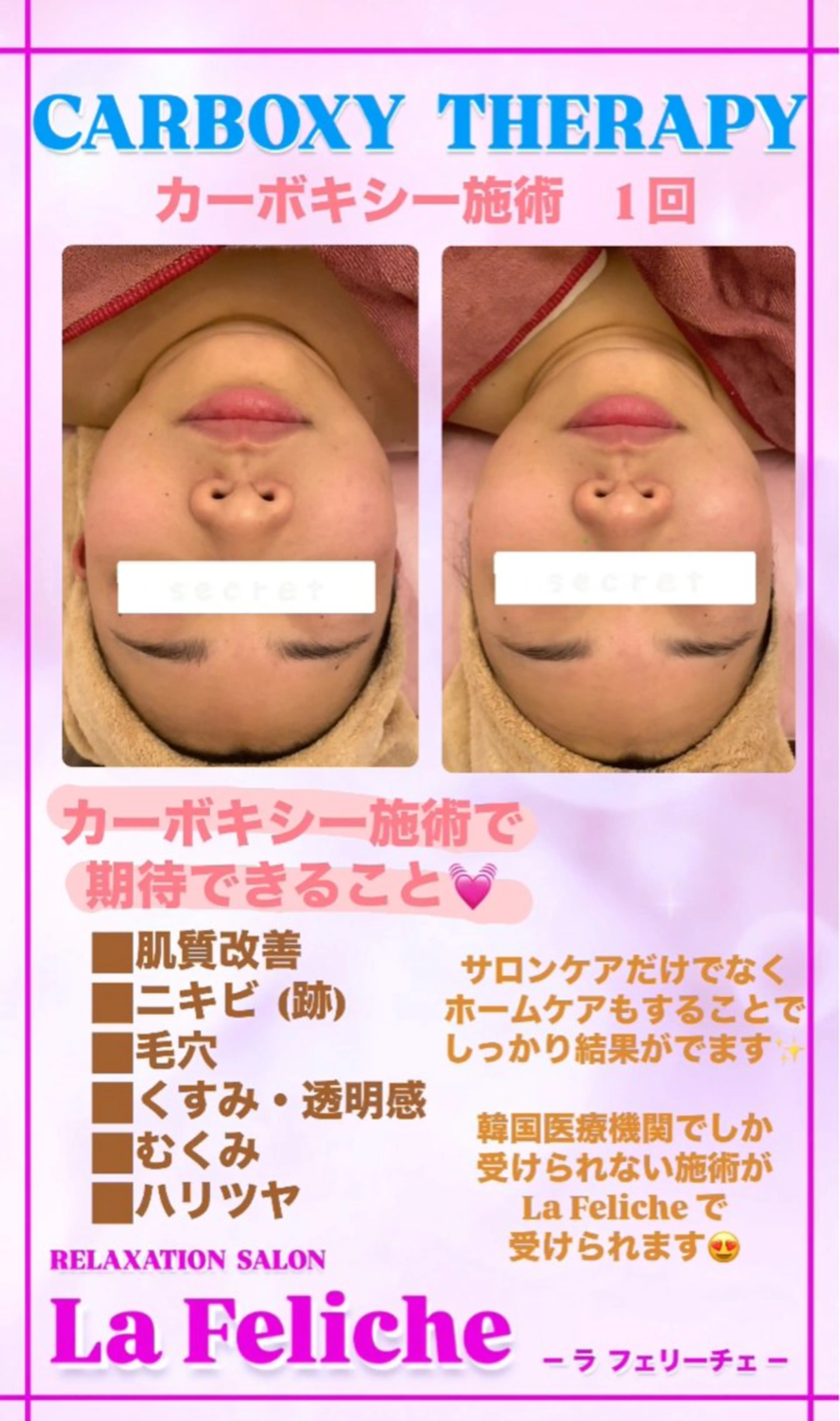 エステ La Feliche 佳奈のエステ・リラクイメージ