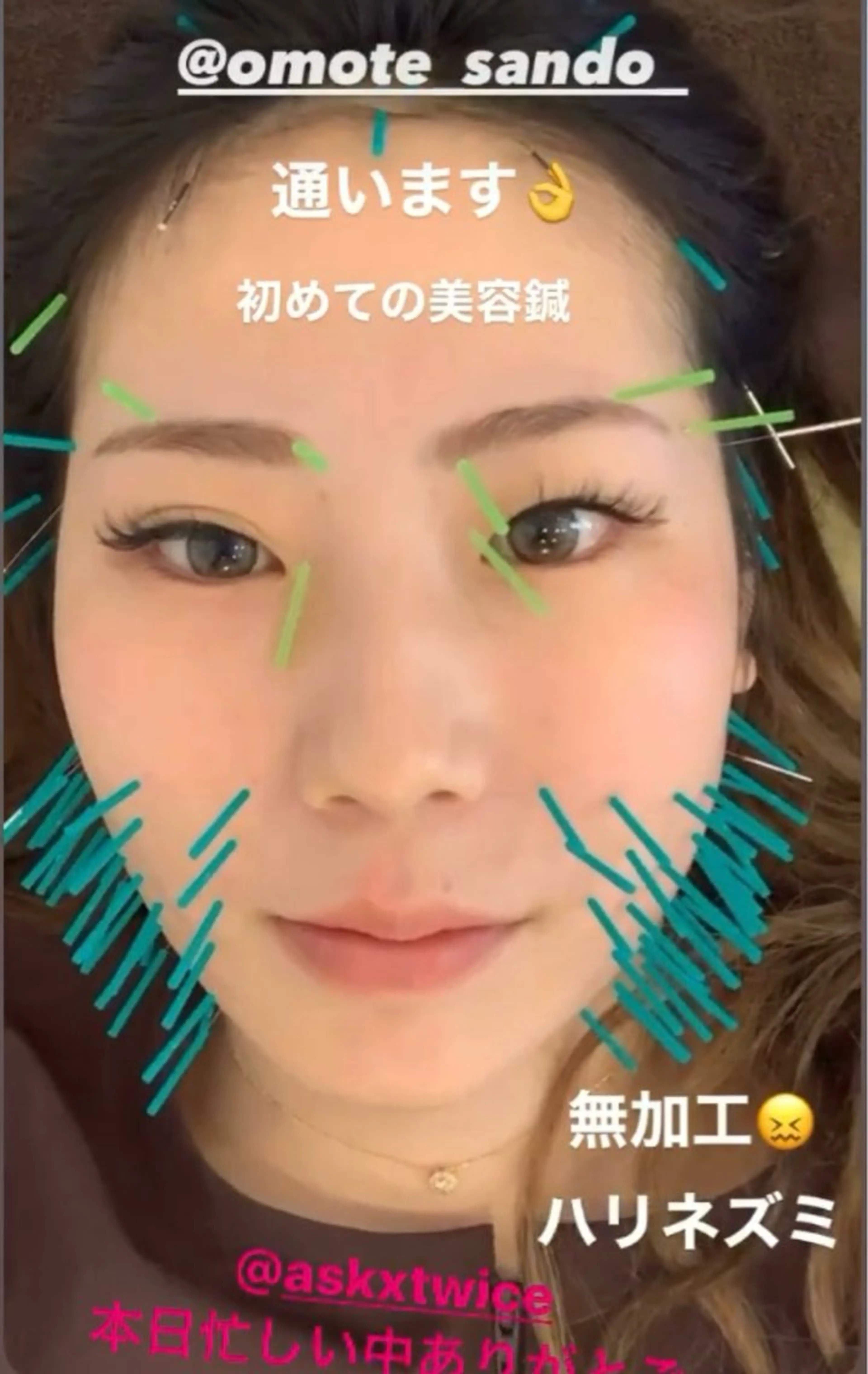 その他 山本 浩司のその他イメージ