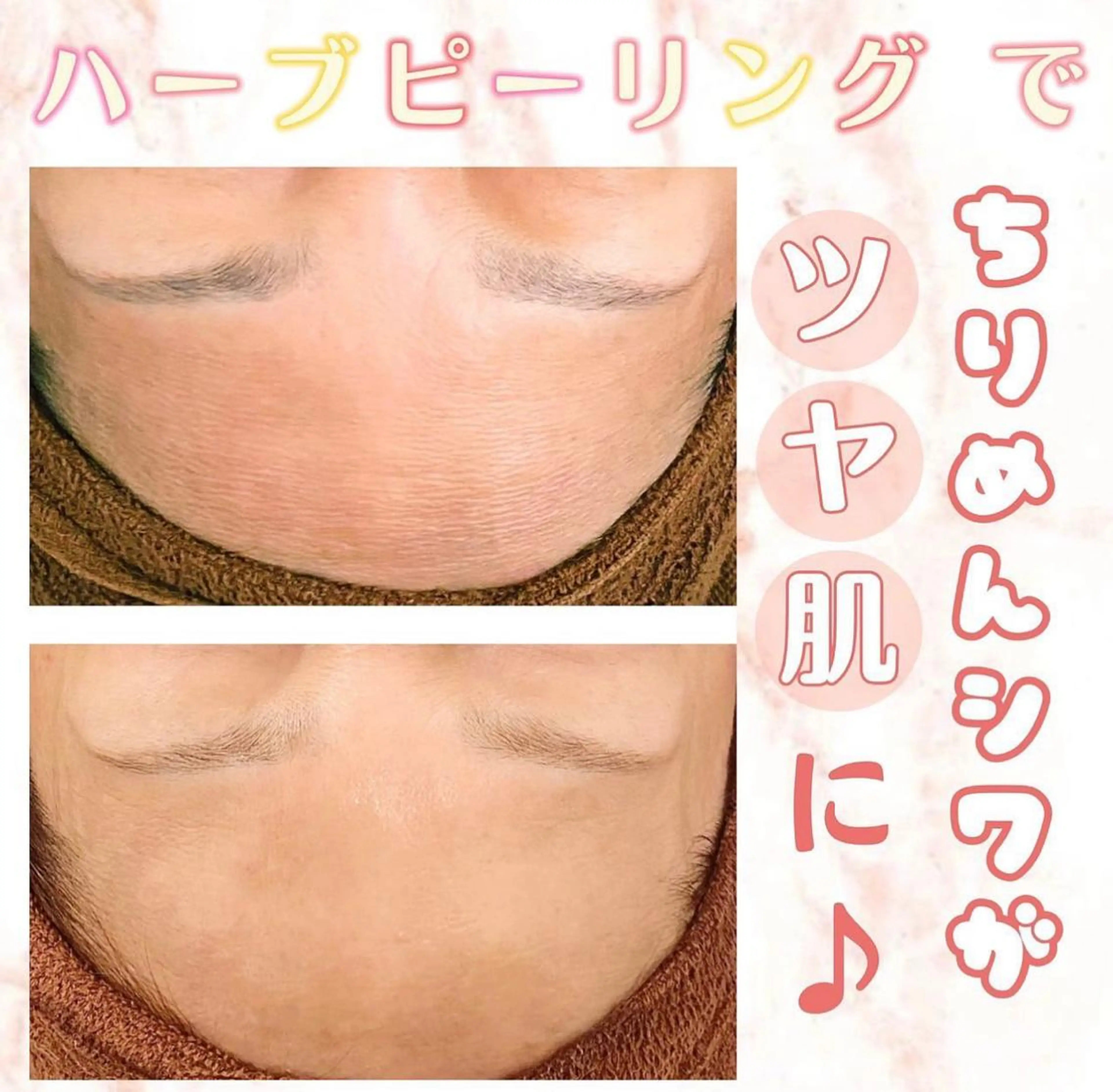 エステ Meow！～トラブル肌専門ピーリング＆脱毛サロン～所属・トラブル肌改善🏥 Meow！🫧🫧のエステ・リラクイメージ