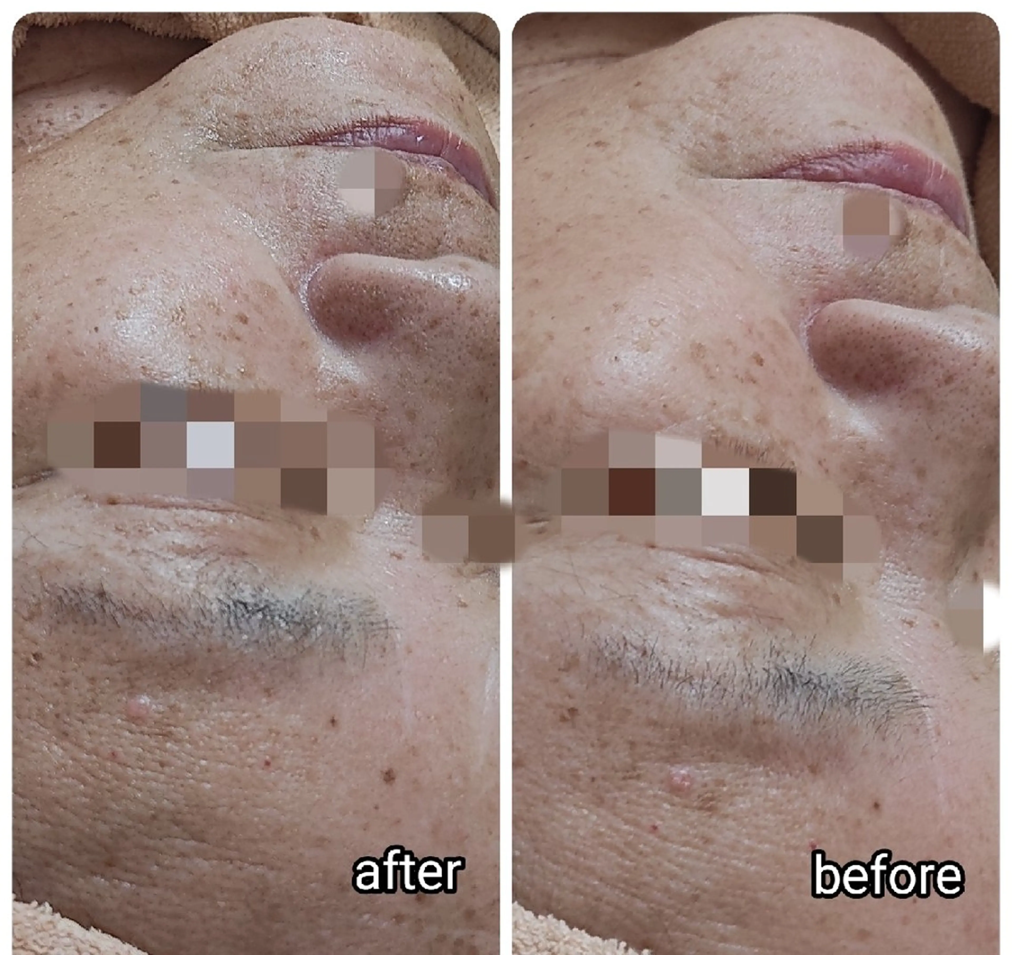 エステ 山野愛子どろんこ美容〜Lough〜所属・山野愛子どろんこ美容 Loughのエステ・リラクイメージ