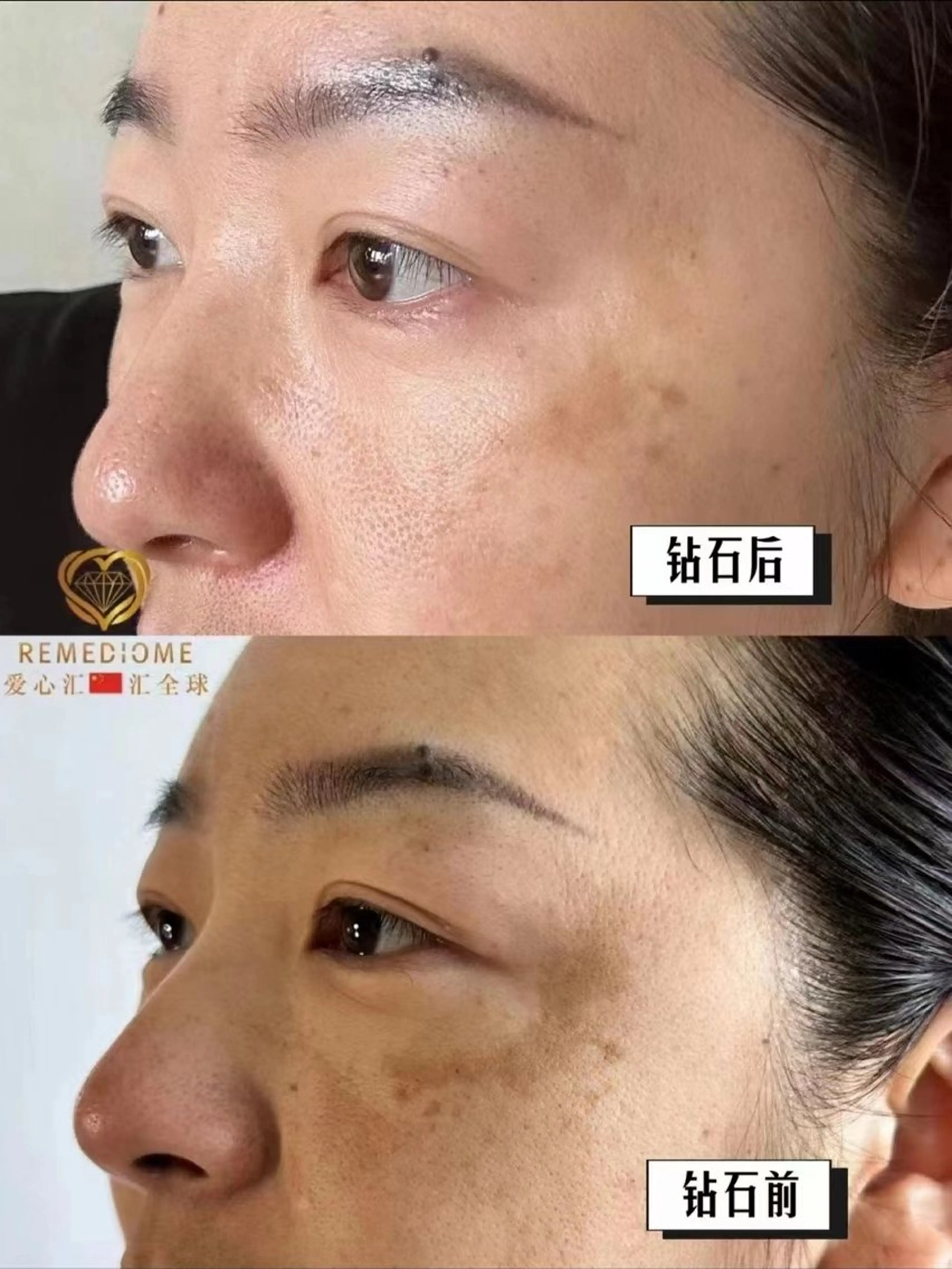 エステ 上福岡 らんらんのネイルデザイン