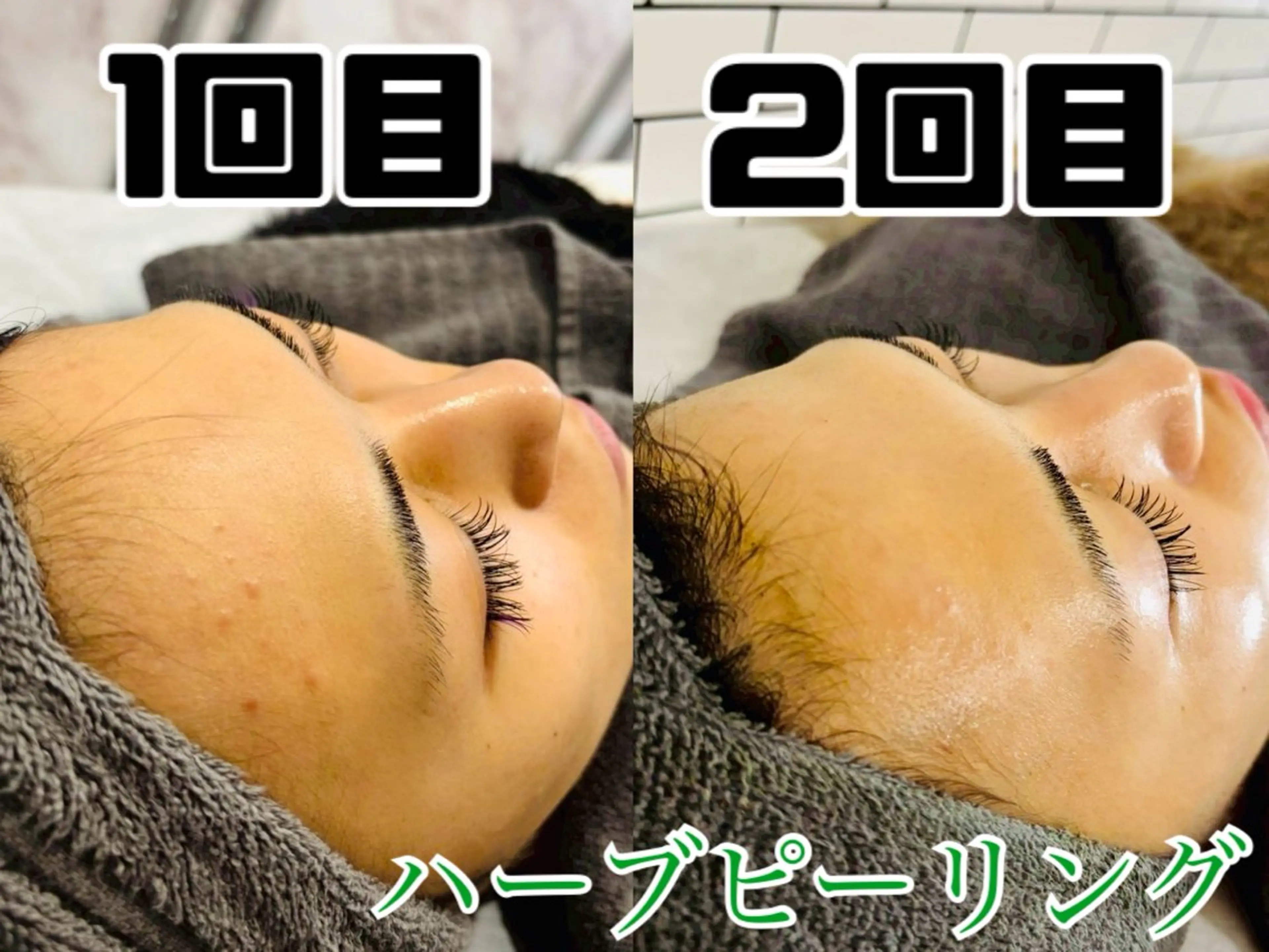 エステ リラク salon SHE° 新宿店🩵のその他イメージ