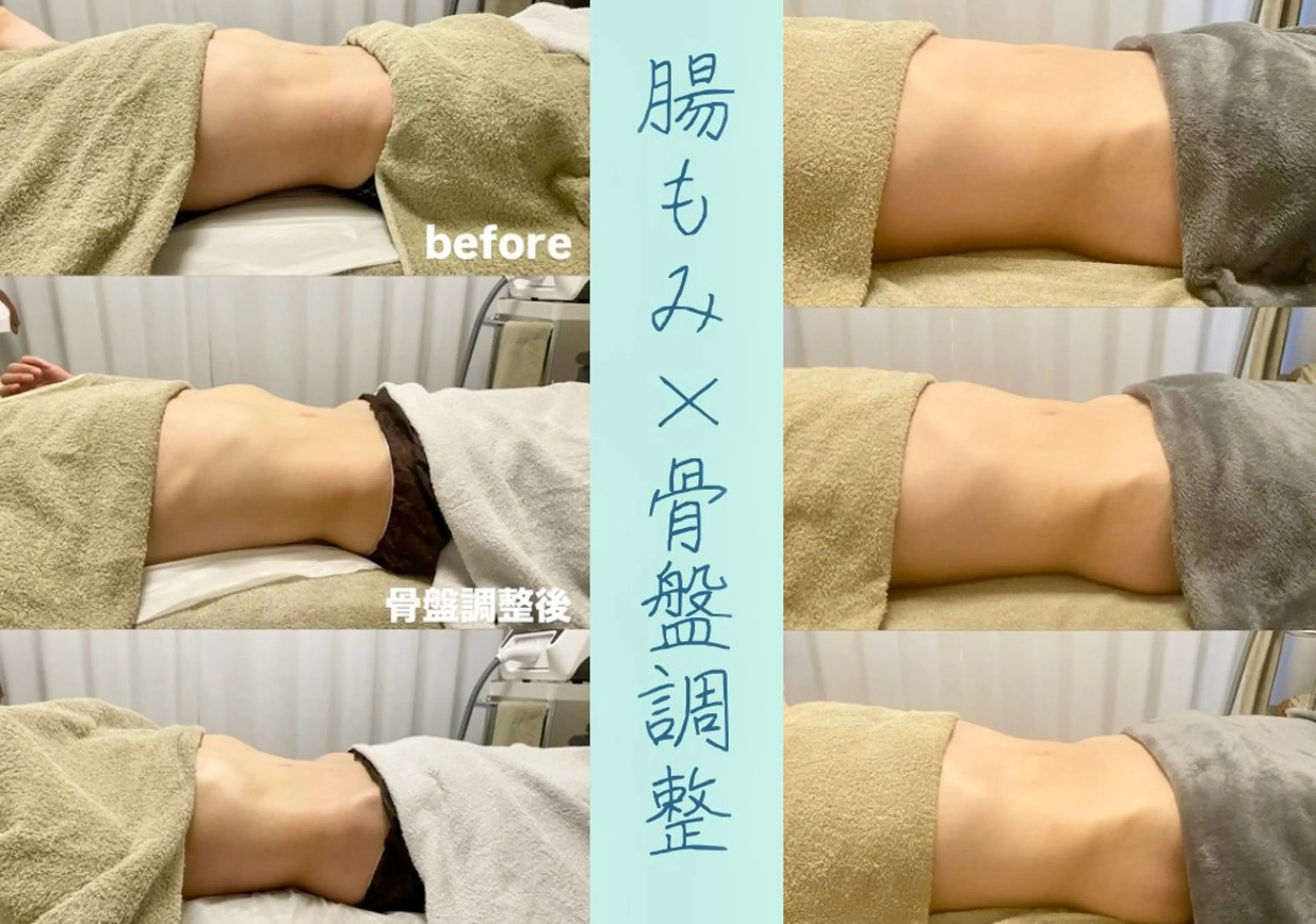 その他 腸もみ・メンズ脱毛・ 毛穴洗浄〜カナロア〜のエステ・リラクイメージ