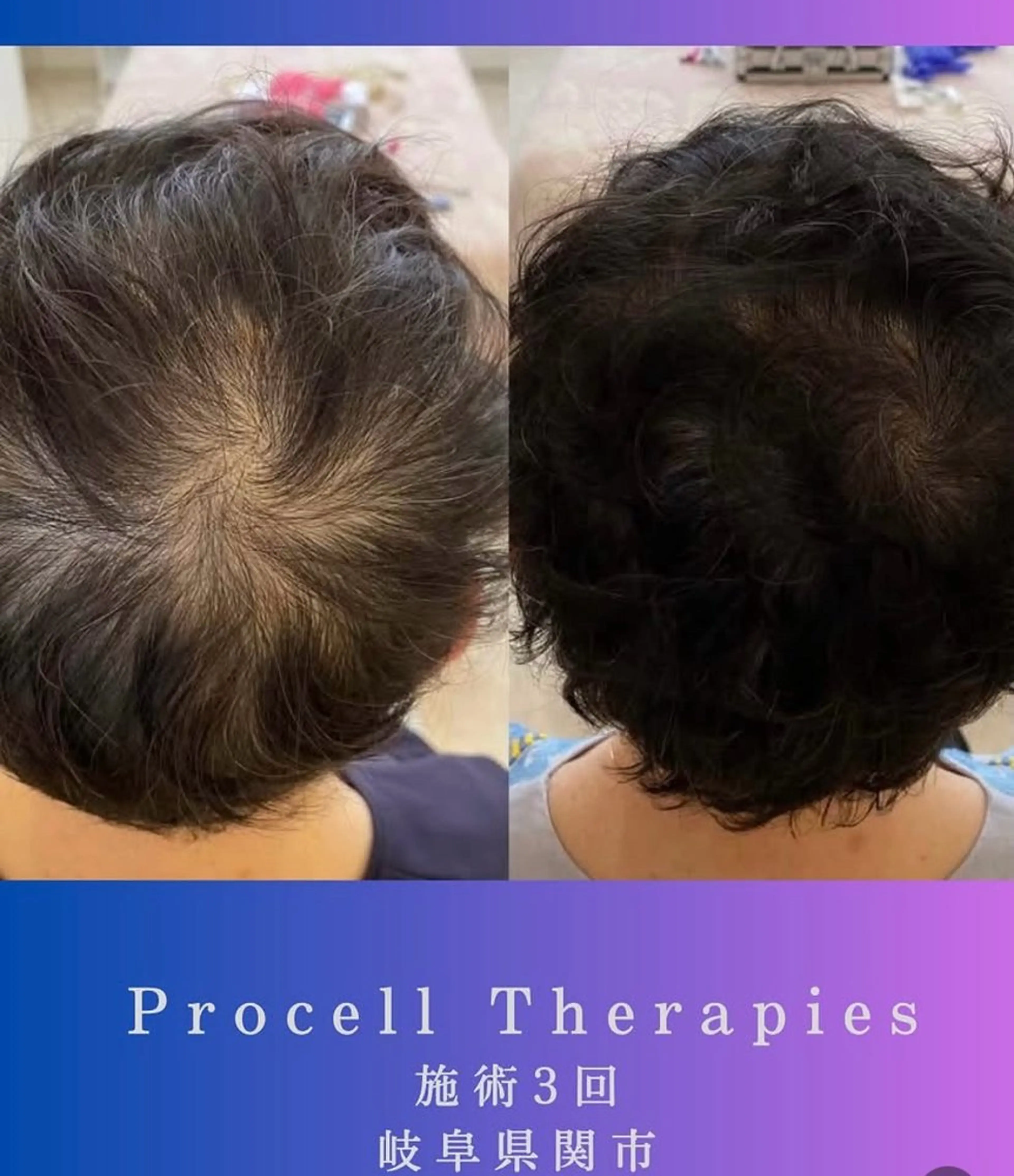 その他 氣楽所属・松下 さゆりのエステ・リラクイメージ