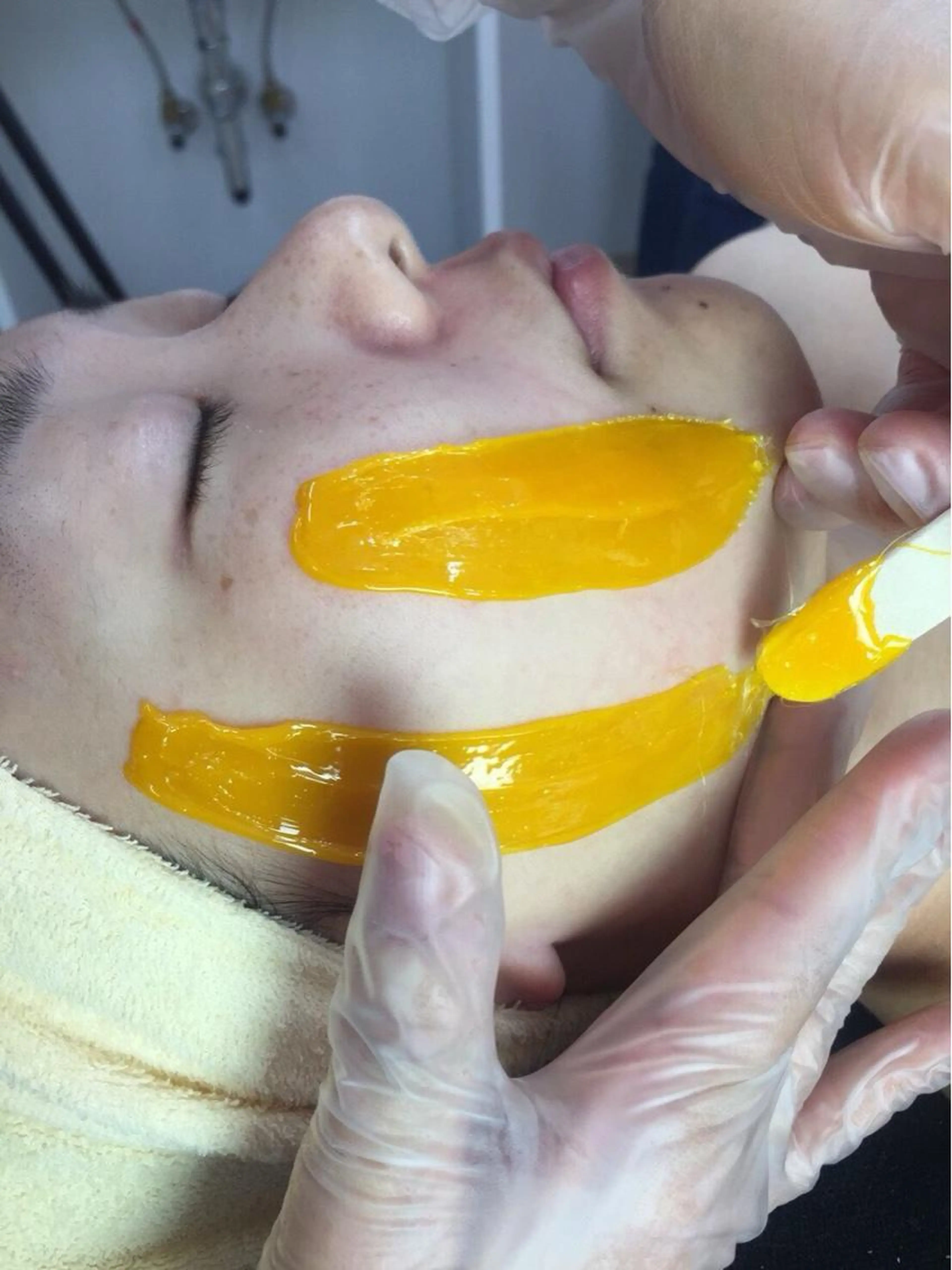【NEW】毛穴をクリーンにし、雑菌を寄せつけない！スキンケアフェイシャルWAXの写真