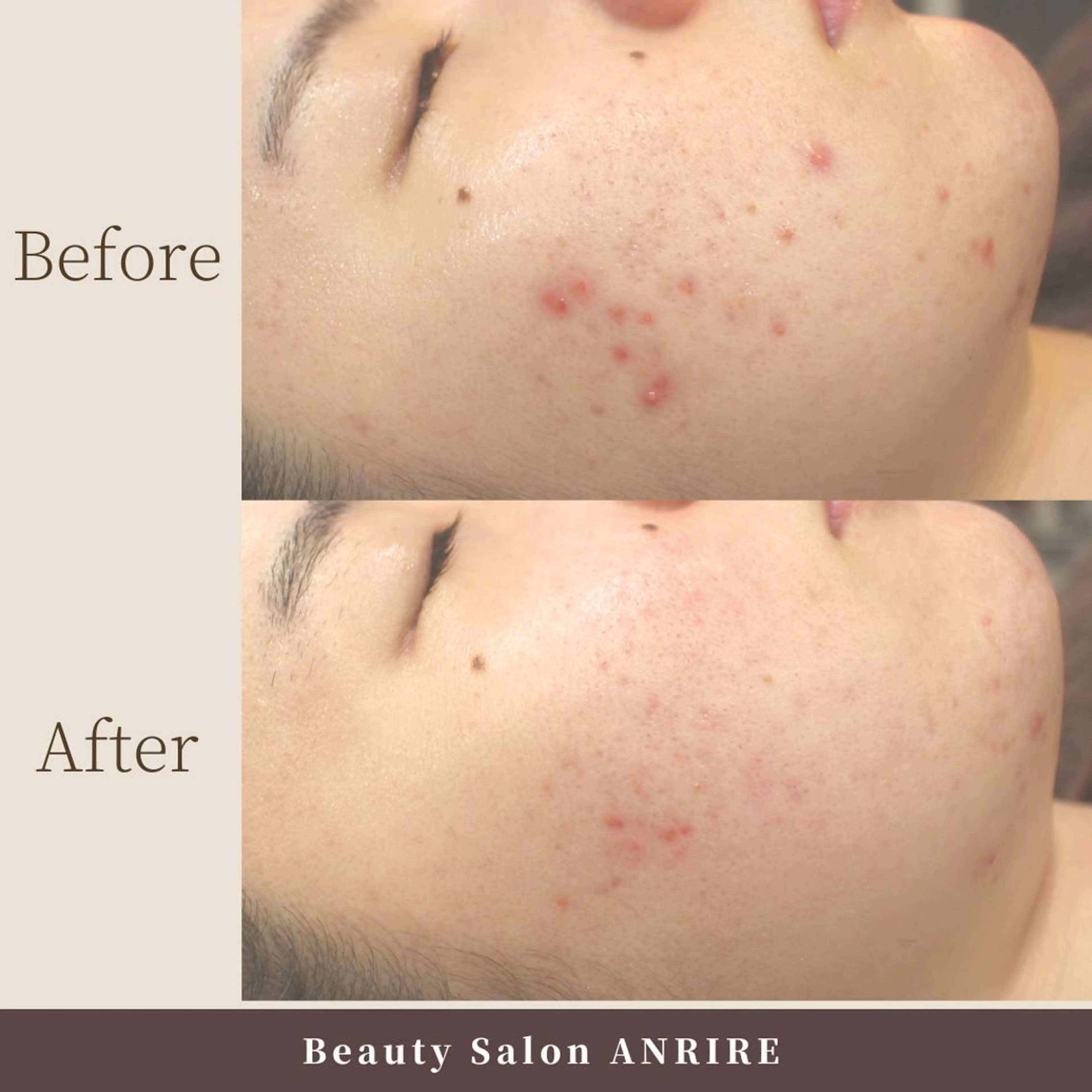 エステ ANRIRE (アンリール)のエステ・リラクイメージ