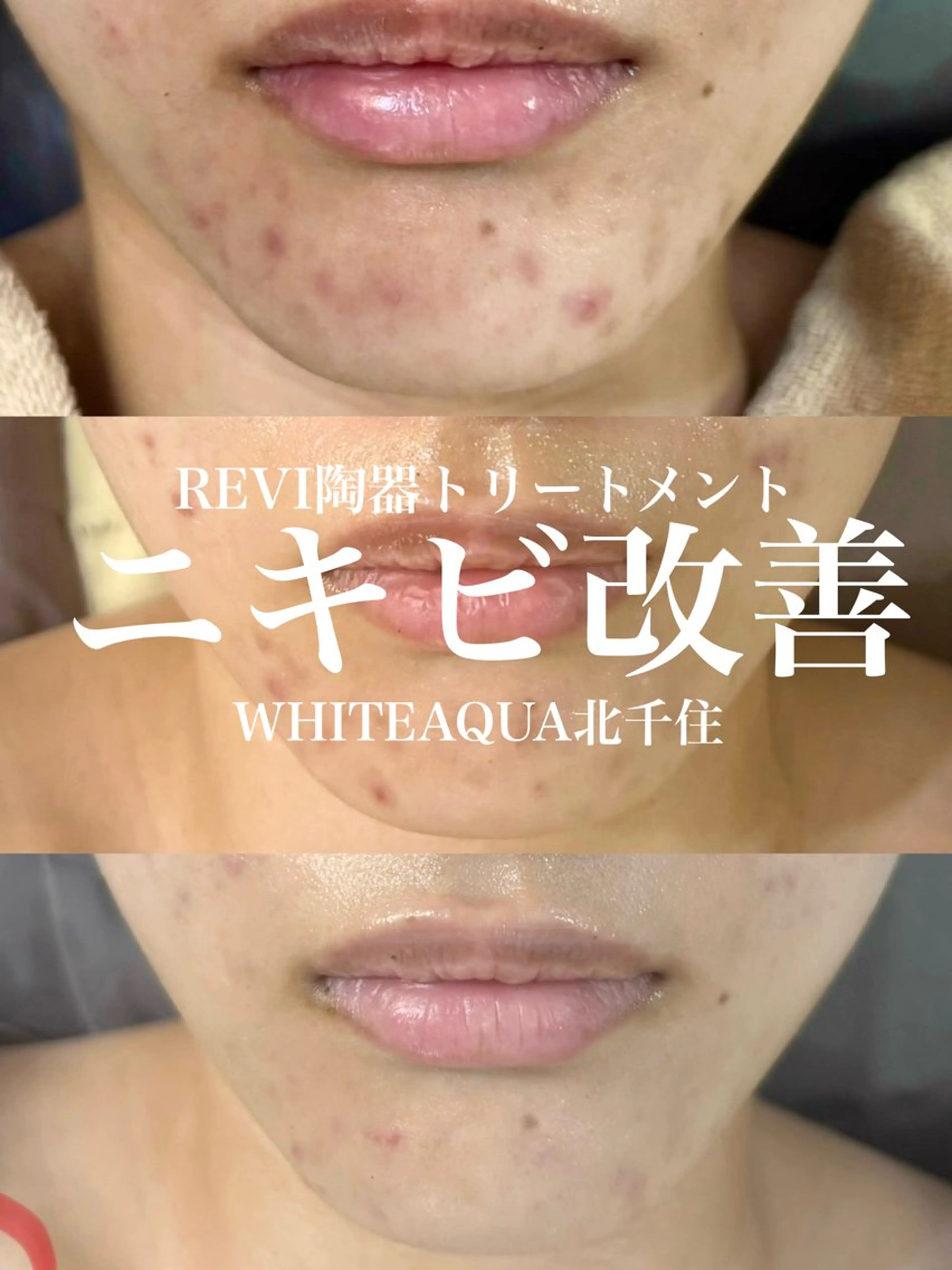 エステ WHITE AQUA 北千住店のエステ・リラクイメージ