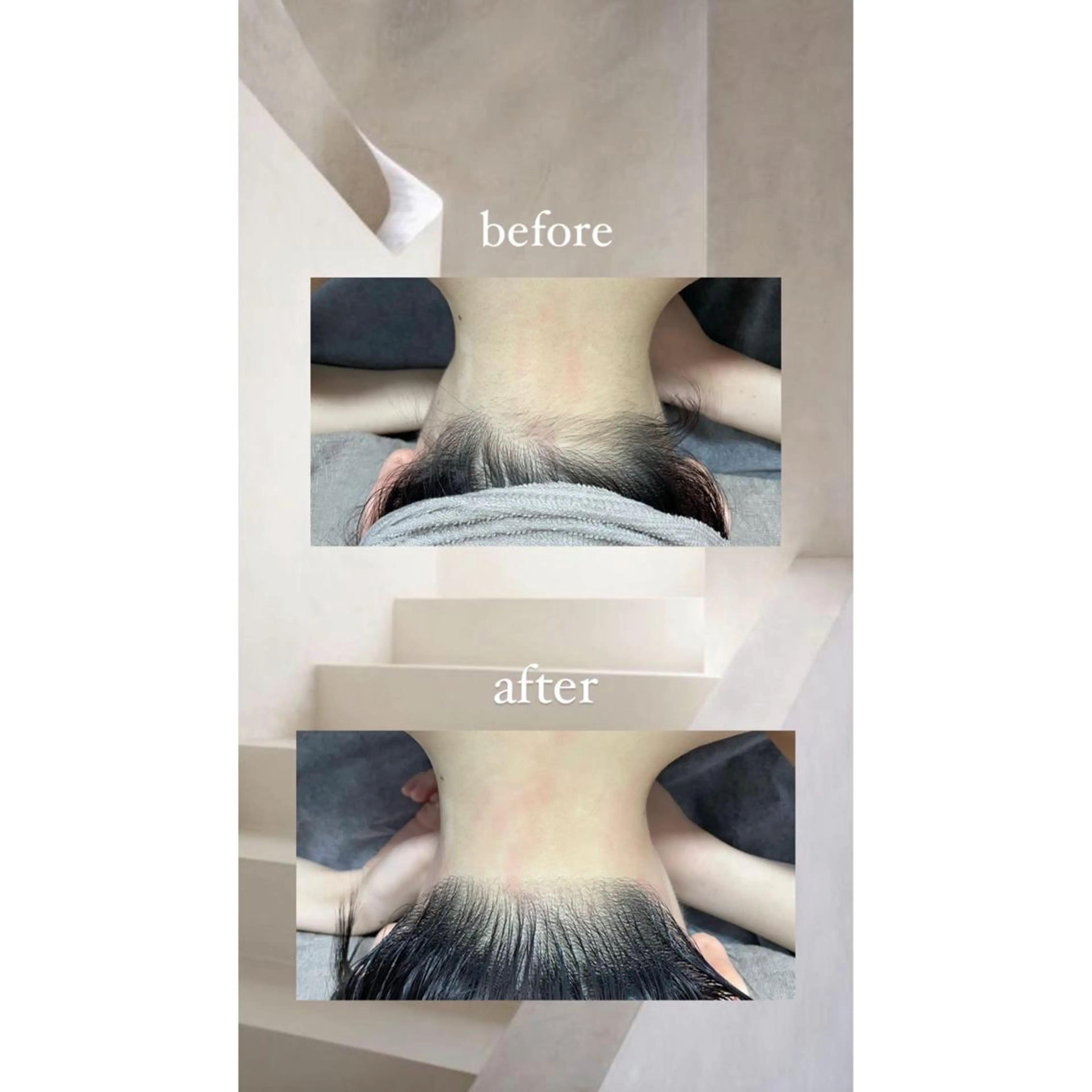 脱毛 crescent所属・【韓国肌管理・脱毛】 クレセントのエステ・リラクイメージ