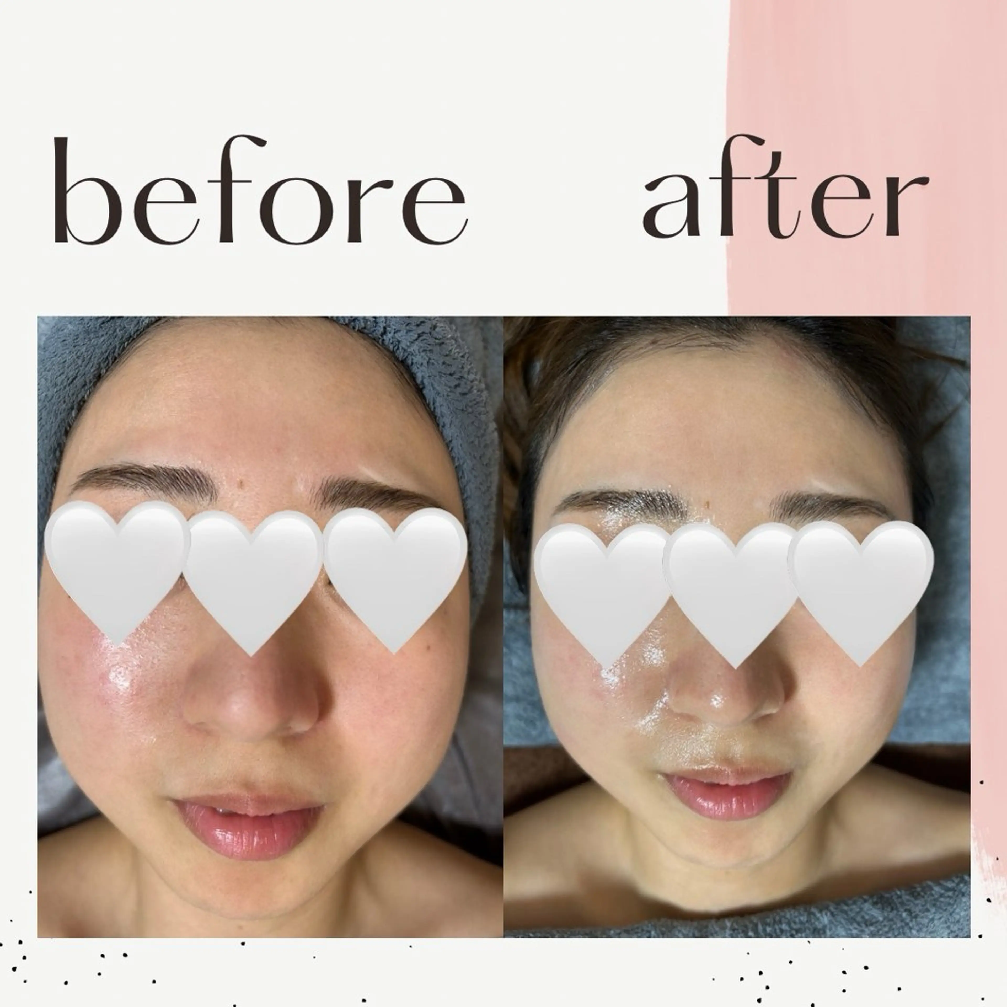 エステ ESTHETIC SALON milulu所属・大栁 晶子のエステ・リラクイメージ