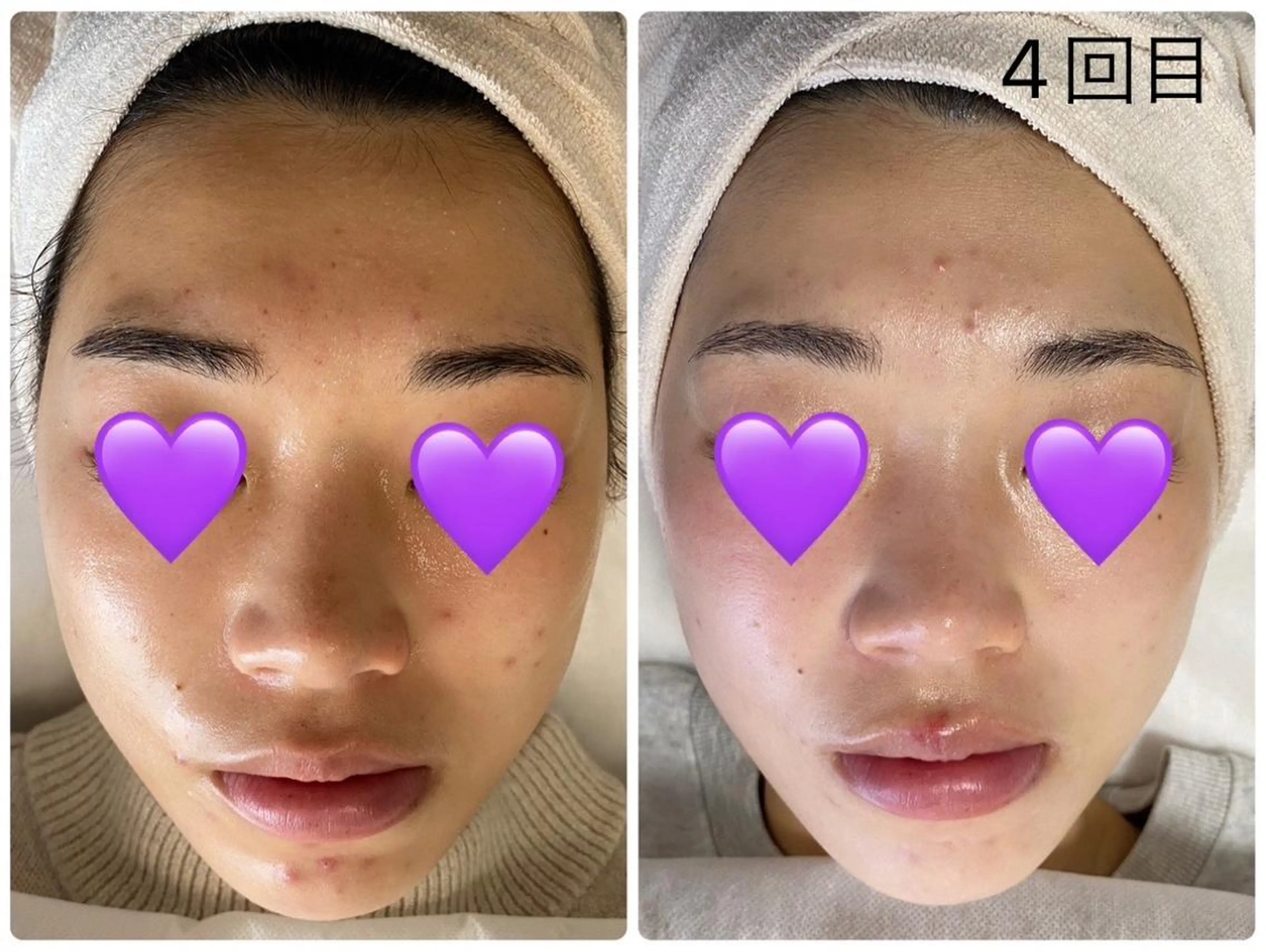 De I'm トータルビューティーサロン所属・COCO beautyサロンのエステ・リラクイメージ