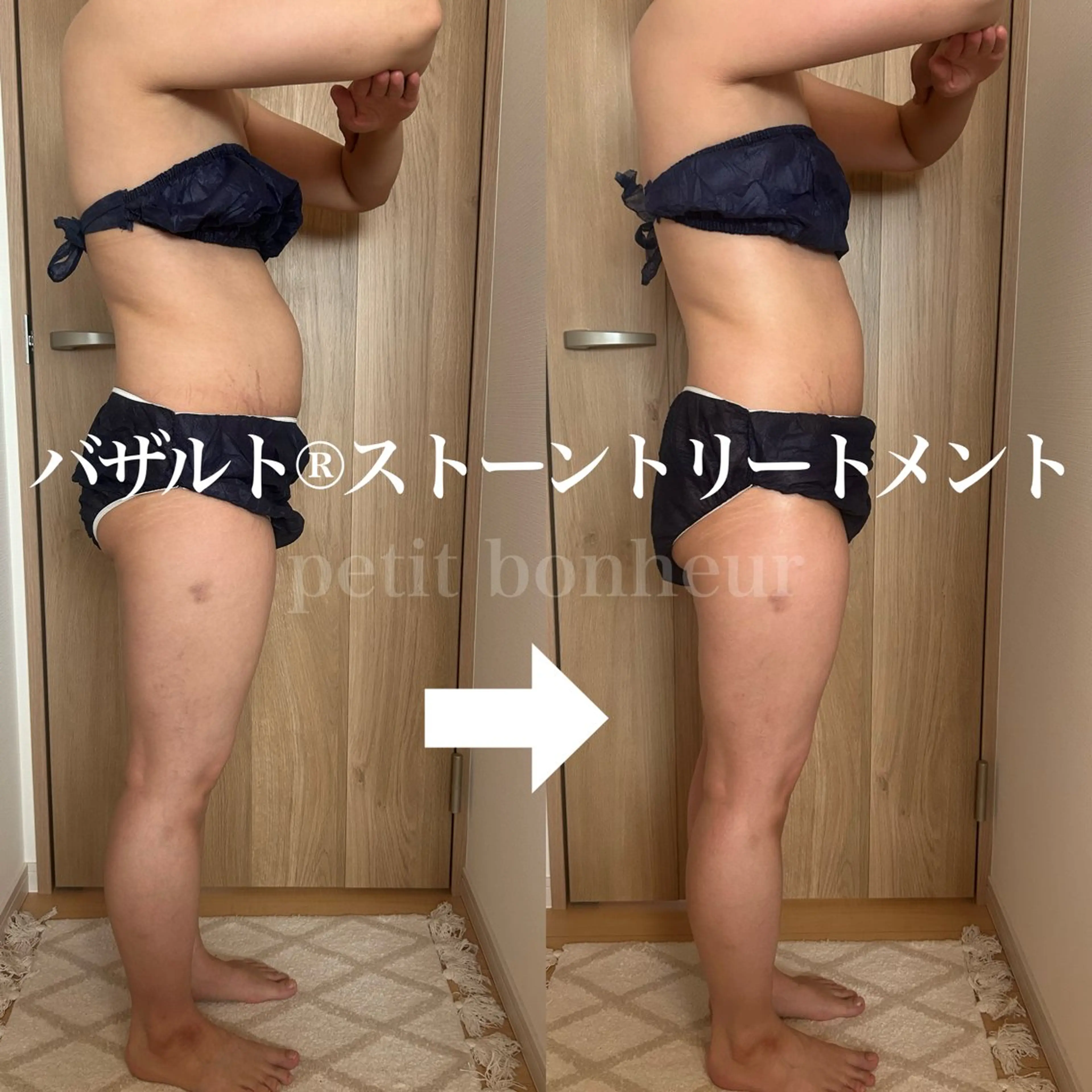 バザルト®︎トリートメント(120分)の写真