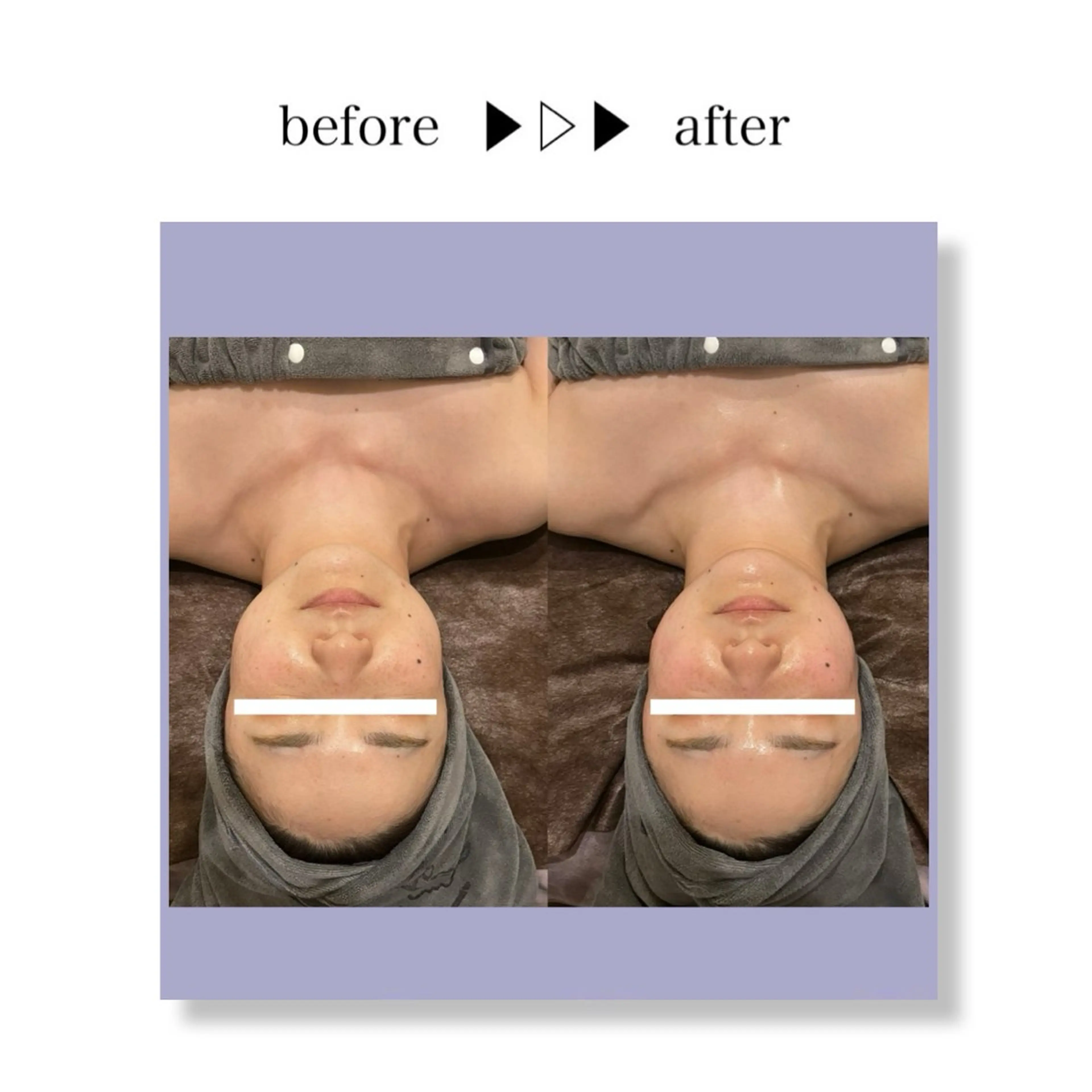 ☆痩身/小顔☆ 結果出します☆のエステ・リラクイメージ