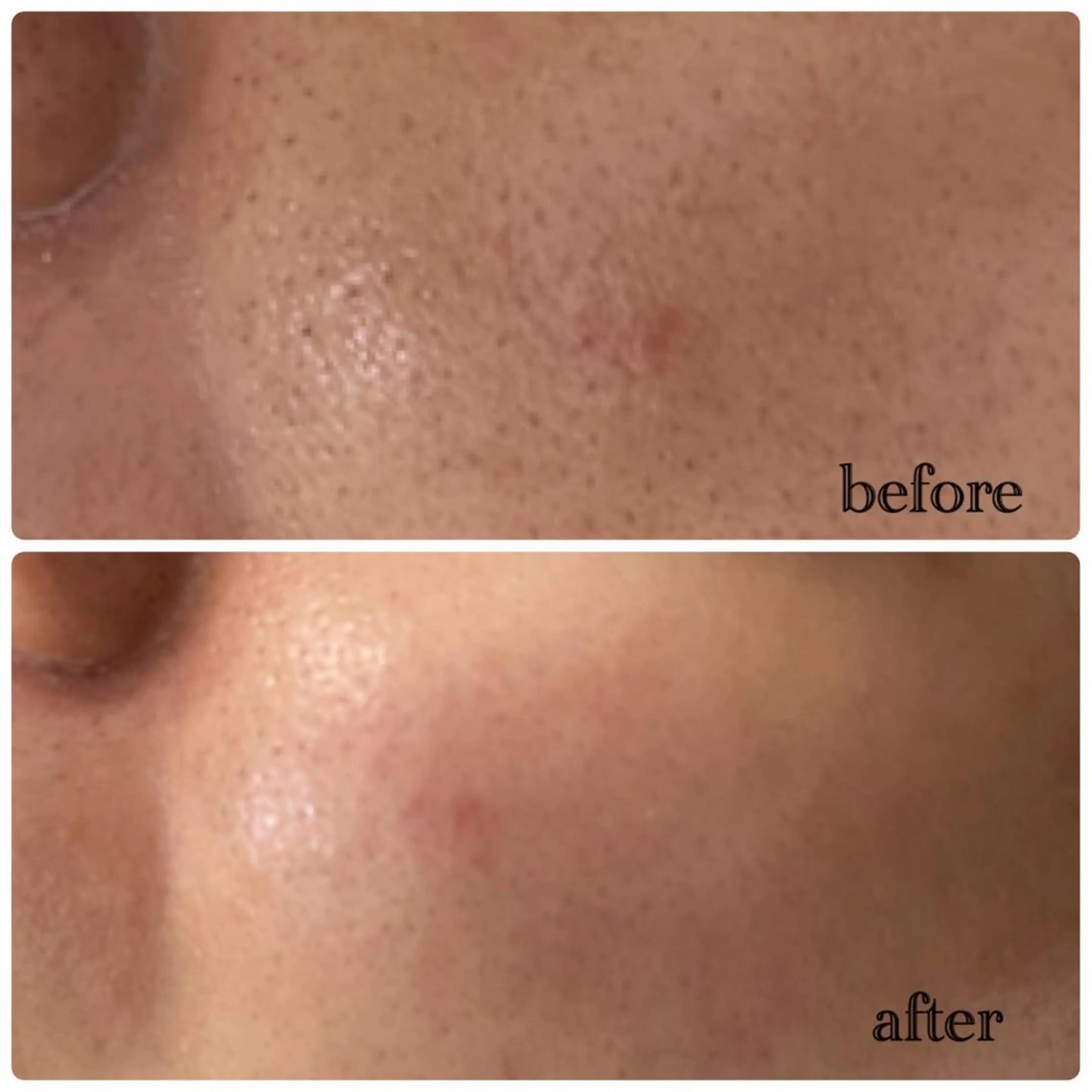 デ・アイム新潟北所属・サイトウ .のエステ・リラクイメージ