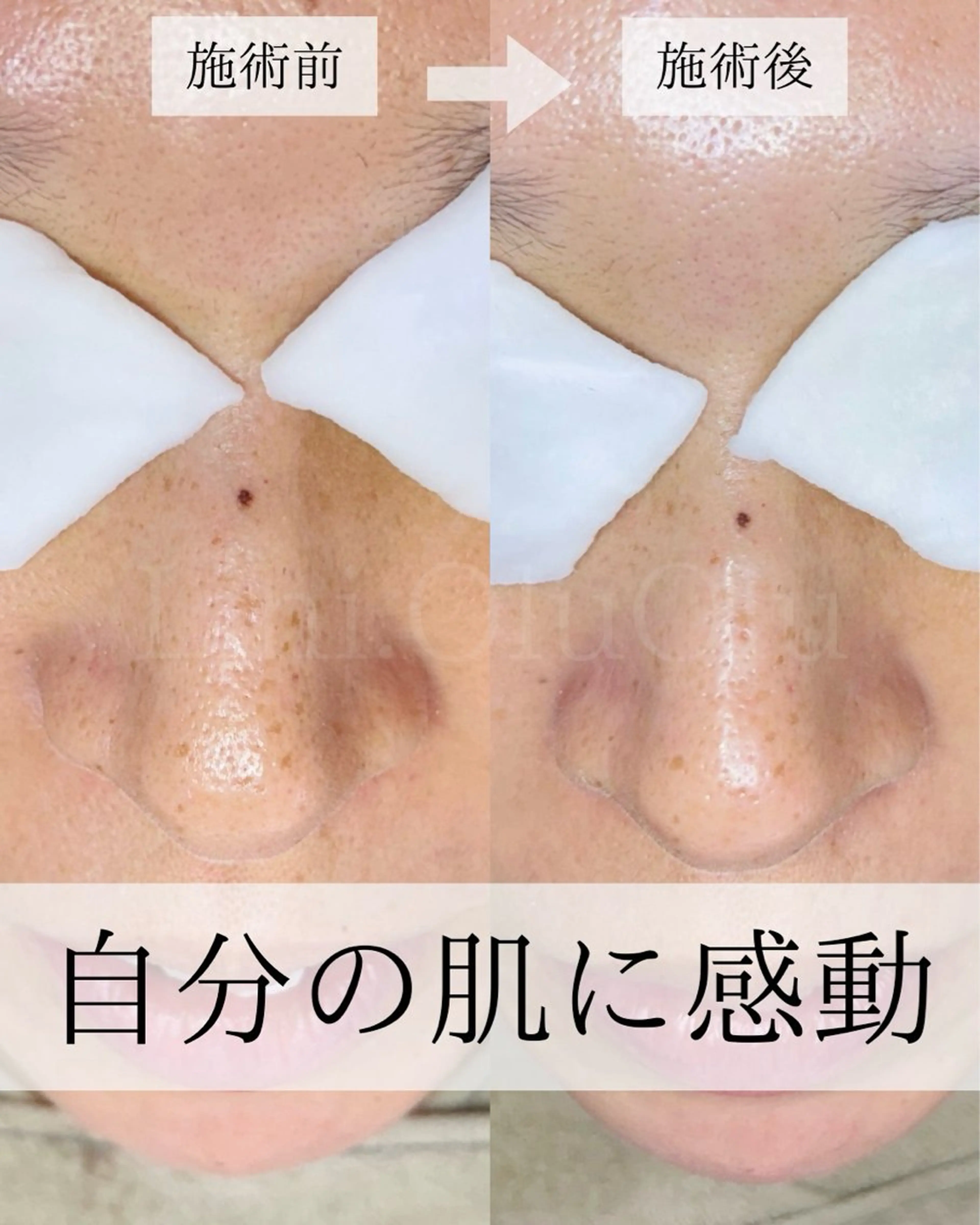 毛穴汚れ改善専門店/ 岸和田/リヒオルオルのエステ・リラクイメージ