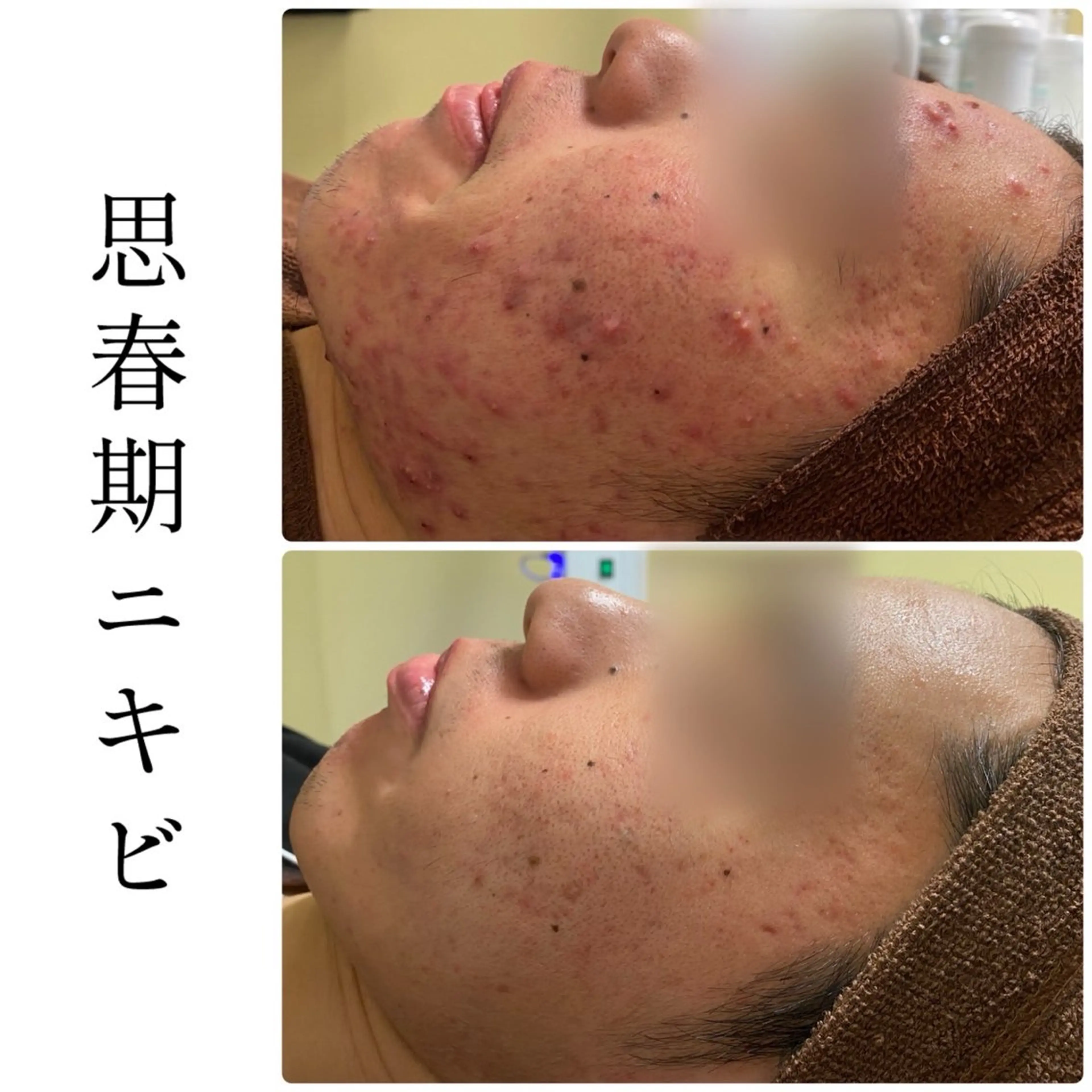 エステ ハーブピーリング専門 BIOEL横浜のエステ・リラクイメージ