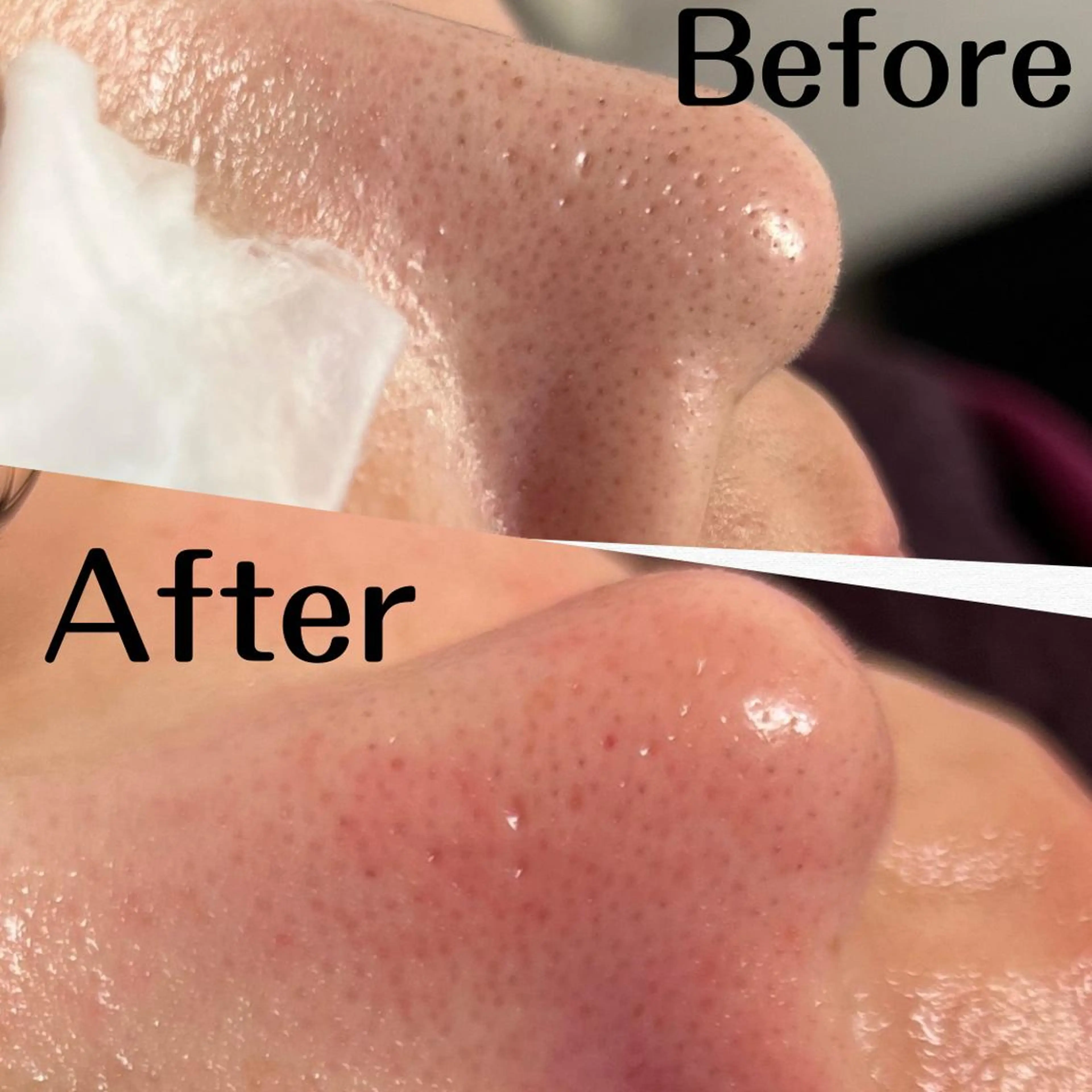 脱毛 &relaxation　M.EMINY所属・大分賀来リラクサロン M.EMINYのエステ・リラクイメージ