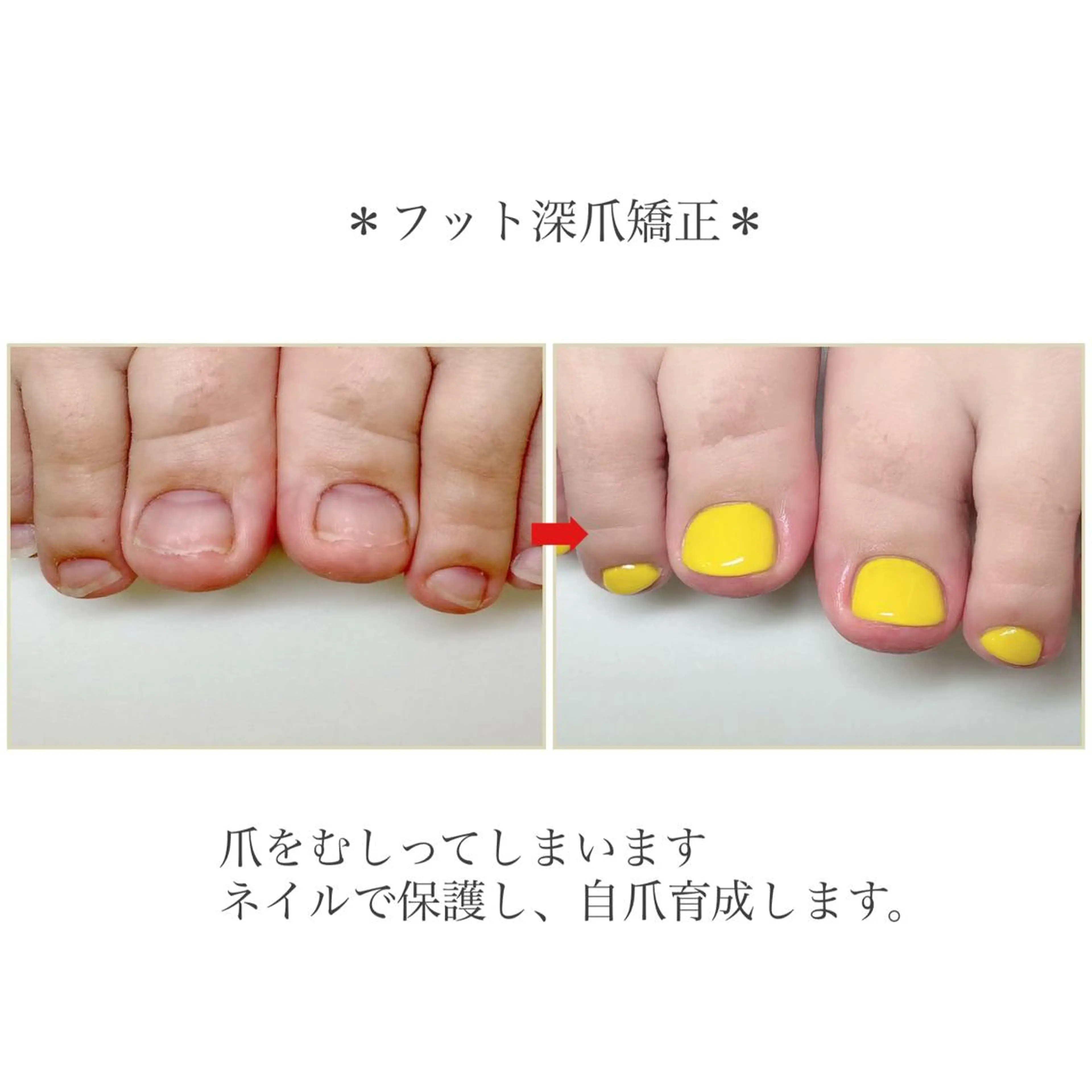 ネイル フットネイル ネイルサロンアリューム所属・ネイルサロン アリュームのネイルデザイン