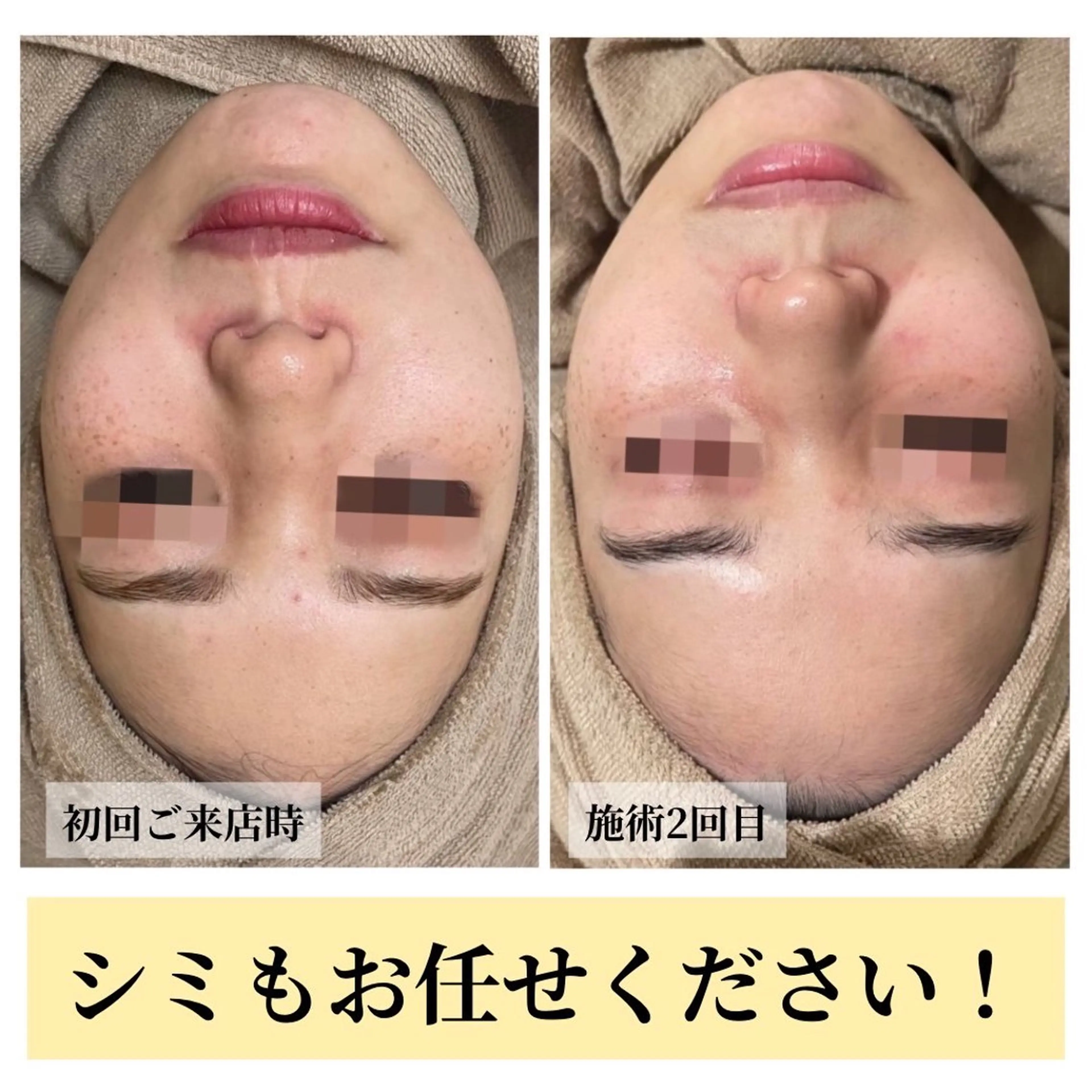 エステ ハーブピーリング・毛穴ケア専門サロンSalon de LENA所属・ハーブピーリング 毛穴専門店/栄のエステ・リラクイメージ