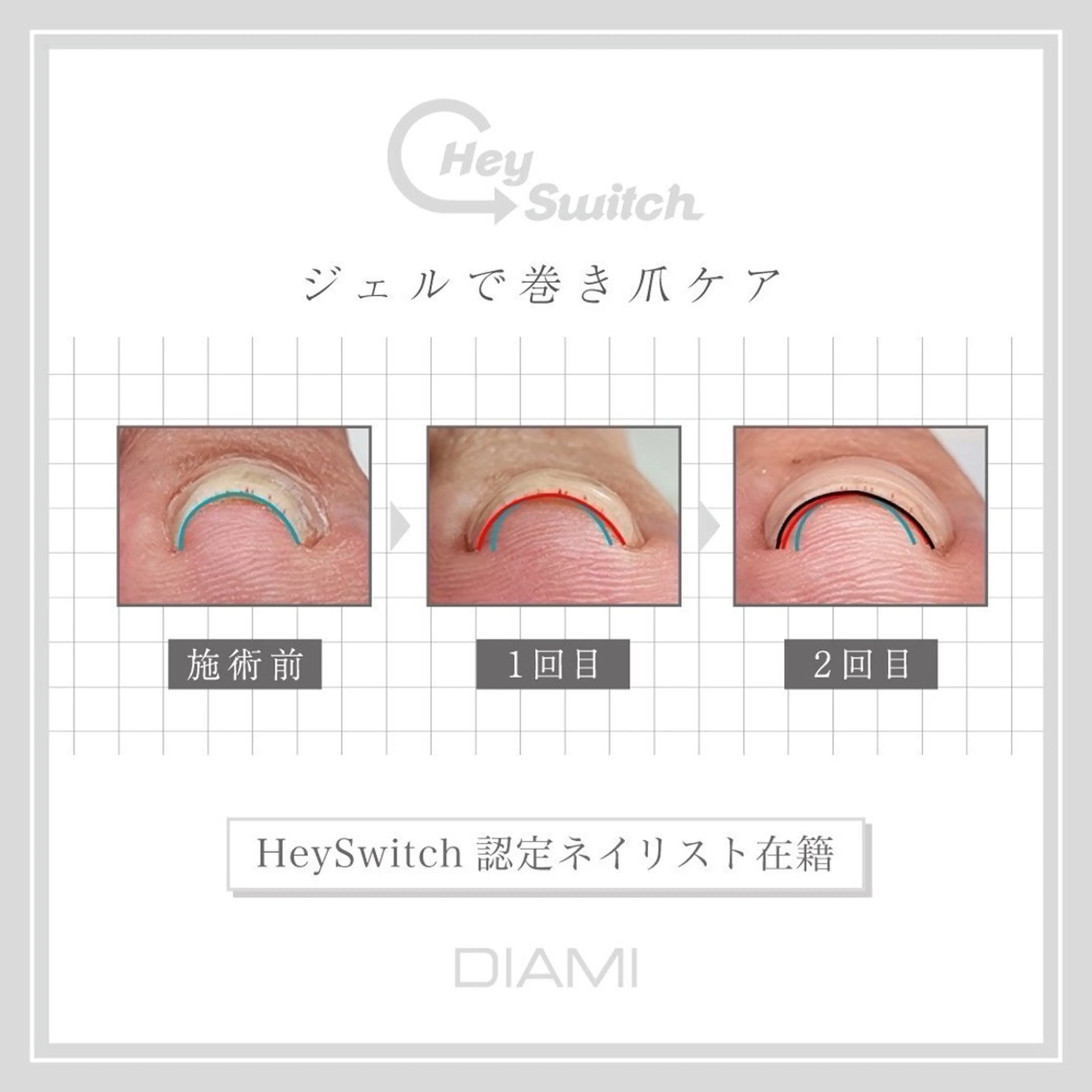 ネイル フットネイル 🎀藤沢ガーリーネイ ル/長さ出し🎀のネイルデザイン