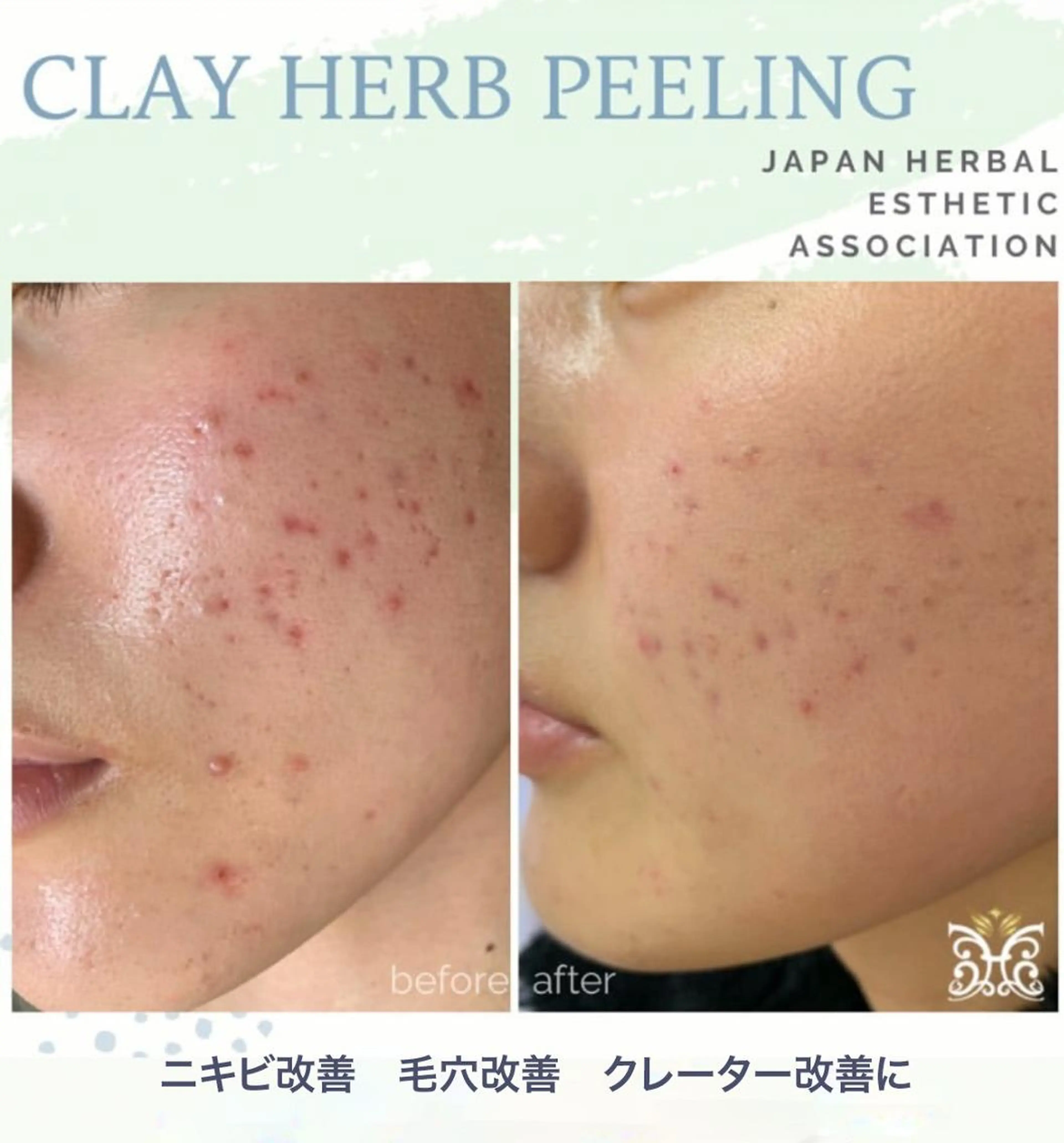 美肌&アロマ🌙 nana 目白/池袋のエステ・リラクイメージ