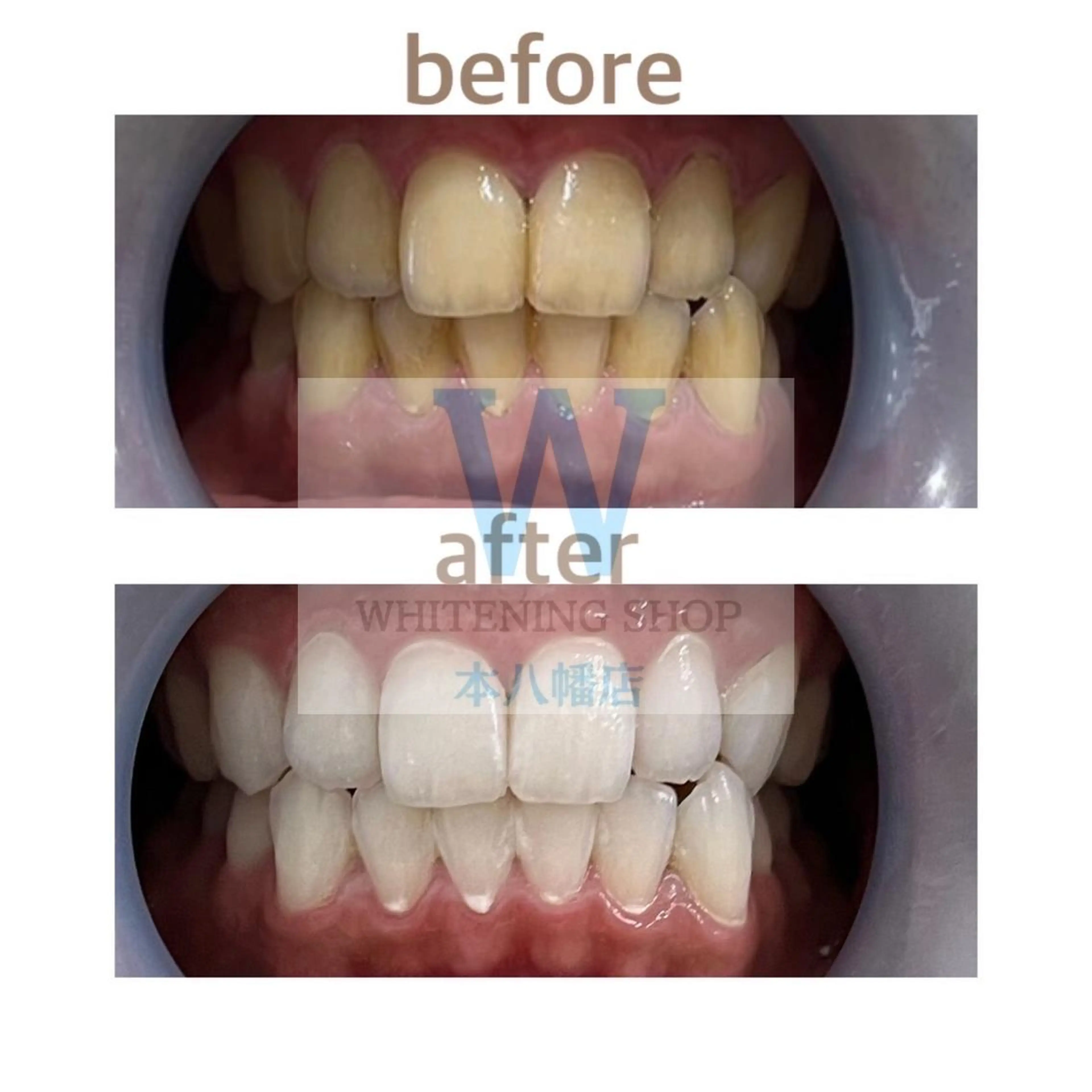 エステ リラク ホワイトニング ショップ本八幡店のエステ・リラクイメージ