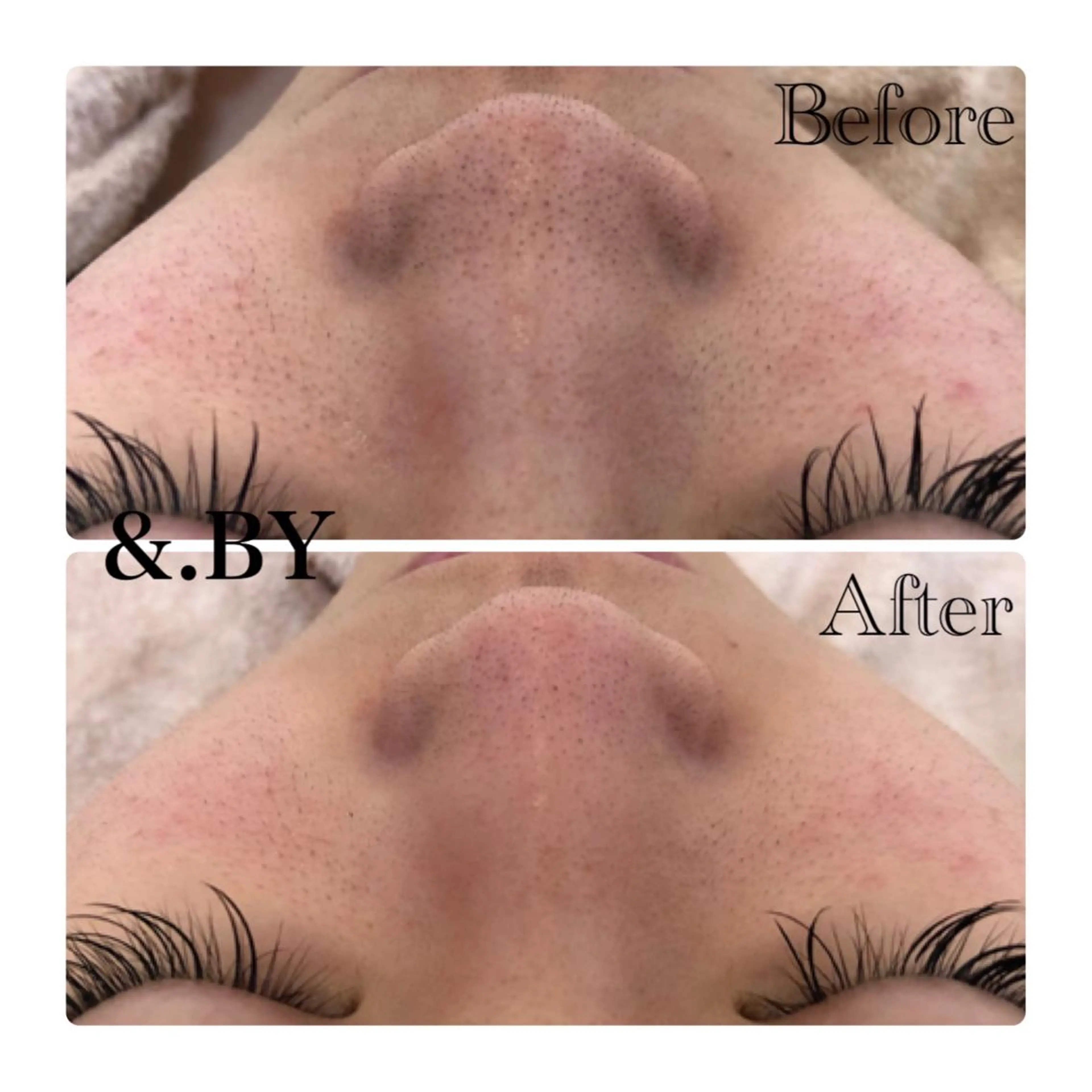 &. BYのエステ・リラクイメージ