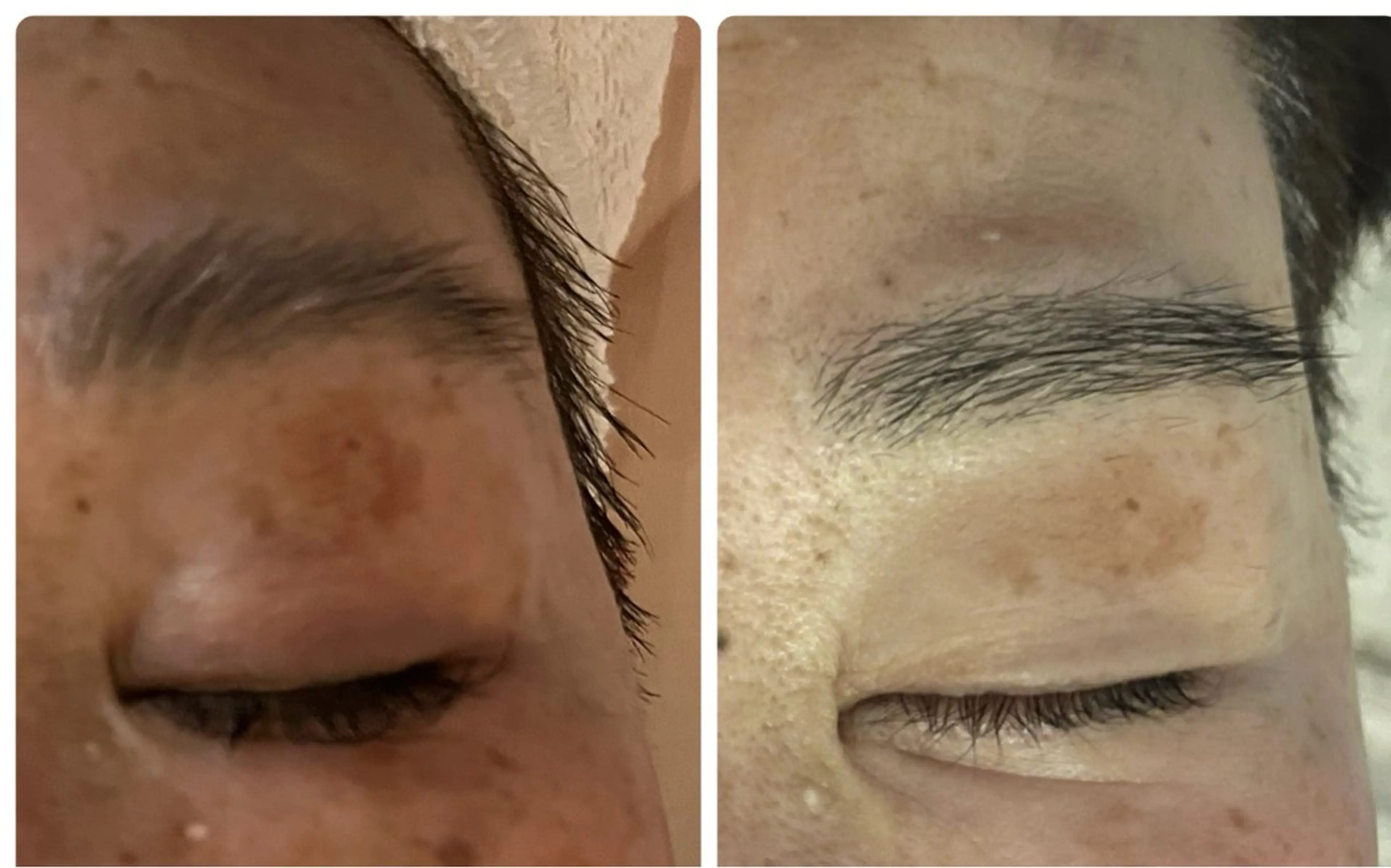 コンシーラーが手放せる しみくすみ透明感フェイシャル☆　　　　　　「隠す毎日」から抜け出す透明感へ【初回体験】の写真