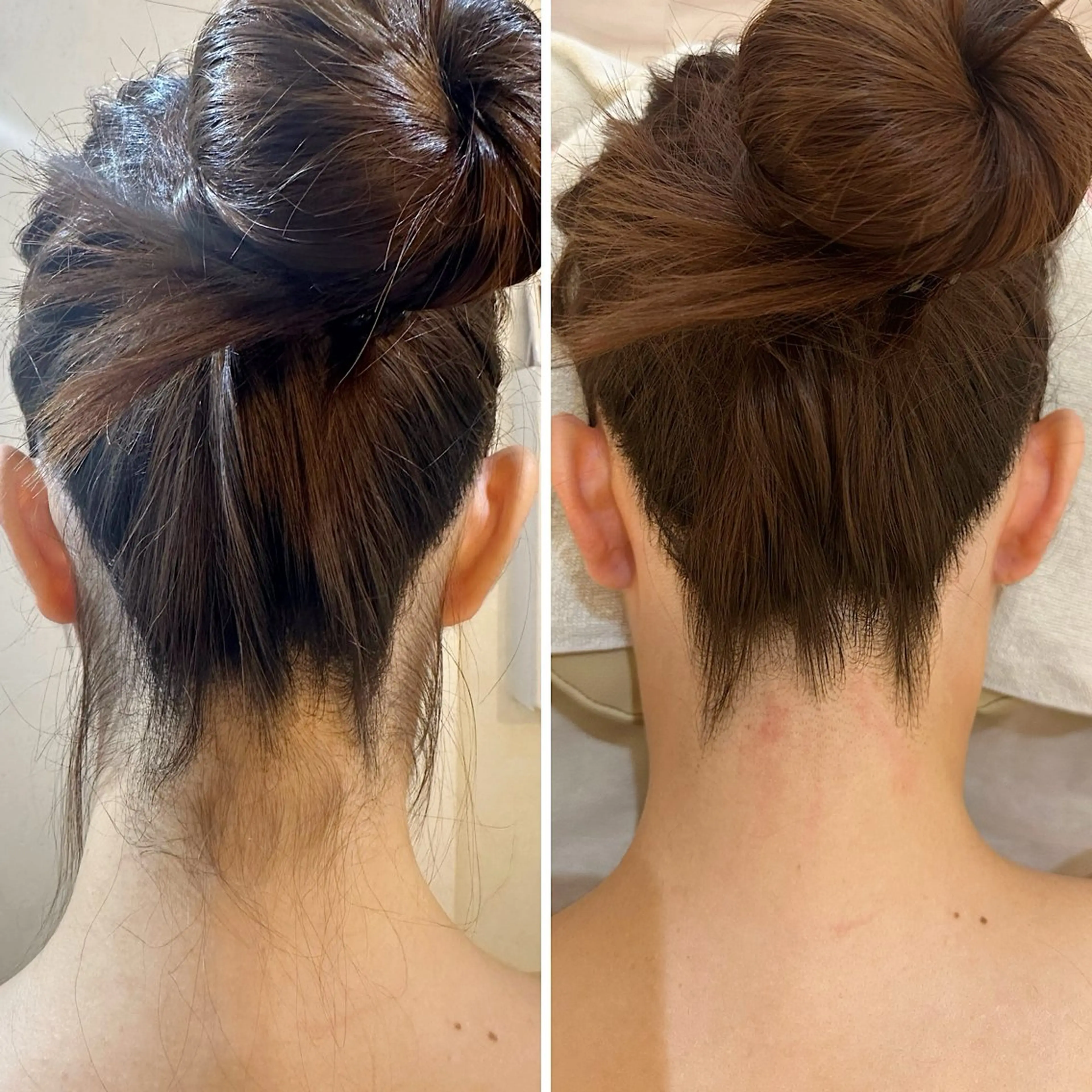 脱毛 うなじ脱毛/美肌脱毛 LABELのエステ・リラクイメージ