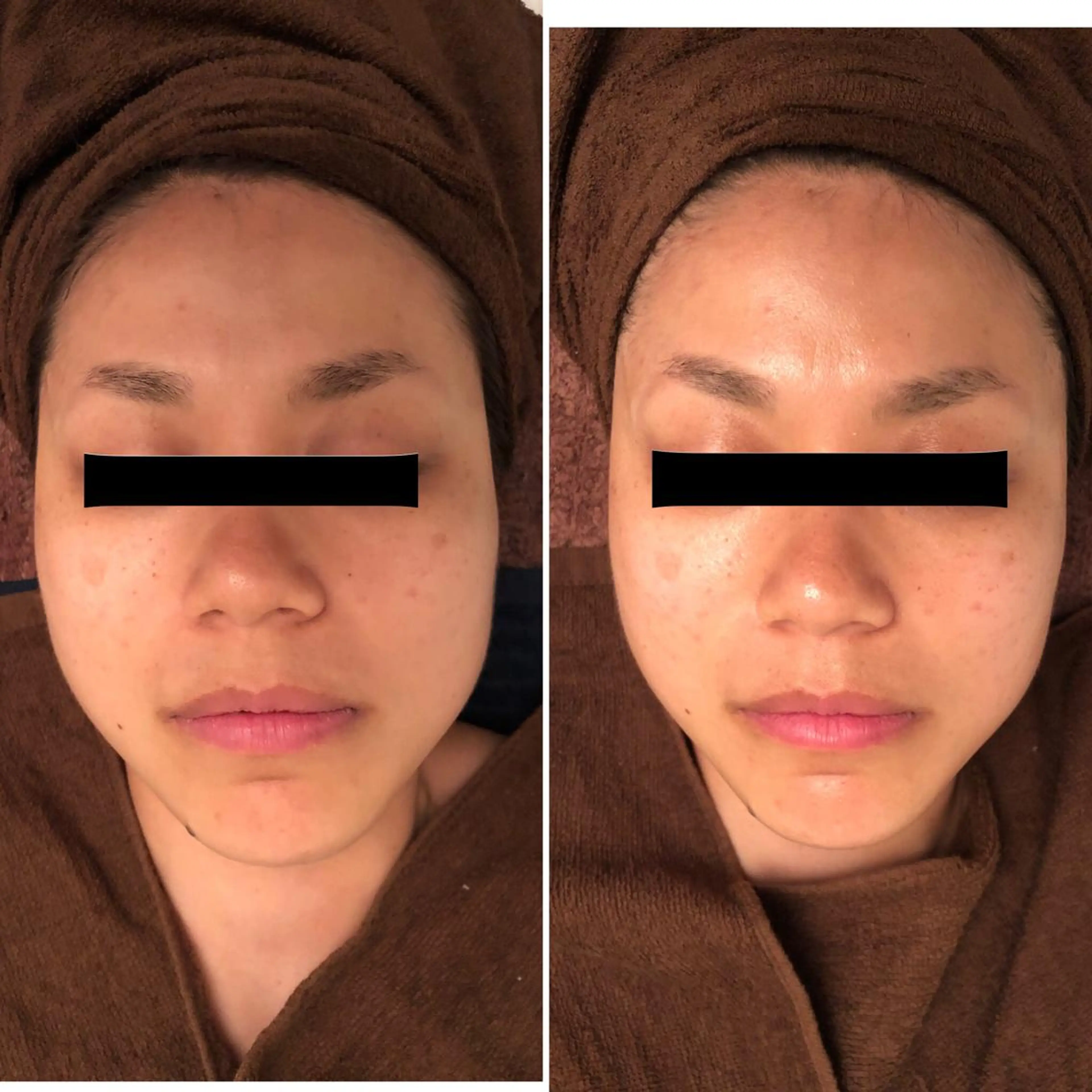 おうちサロン B-ROOMのエステ・リラクイメージ