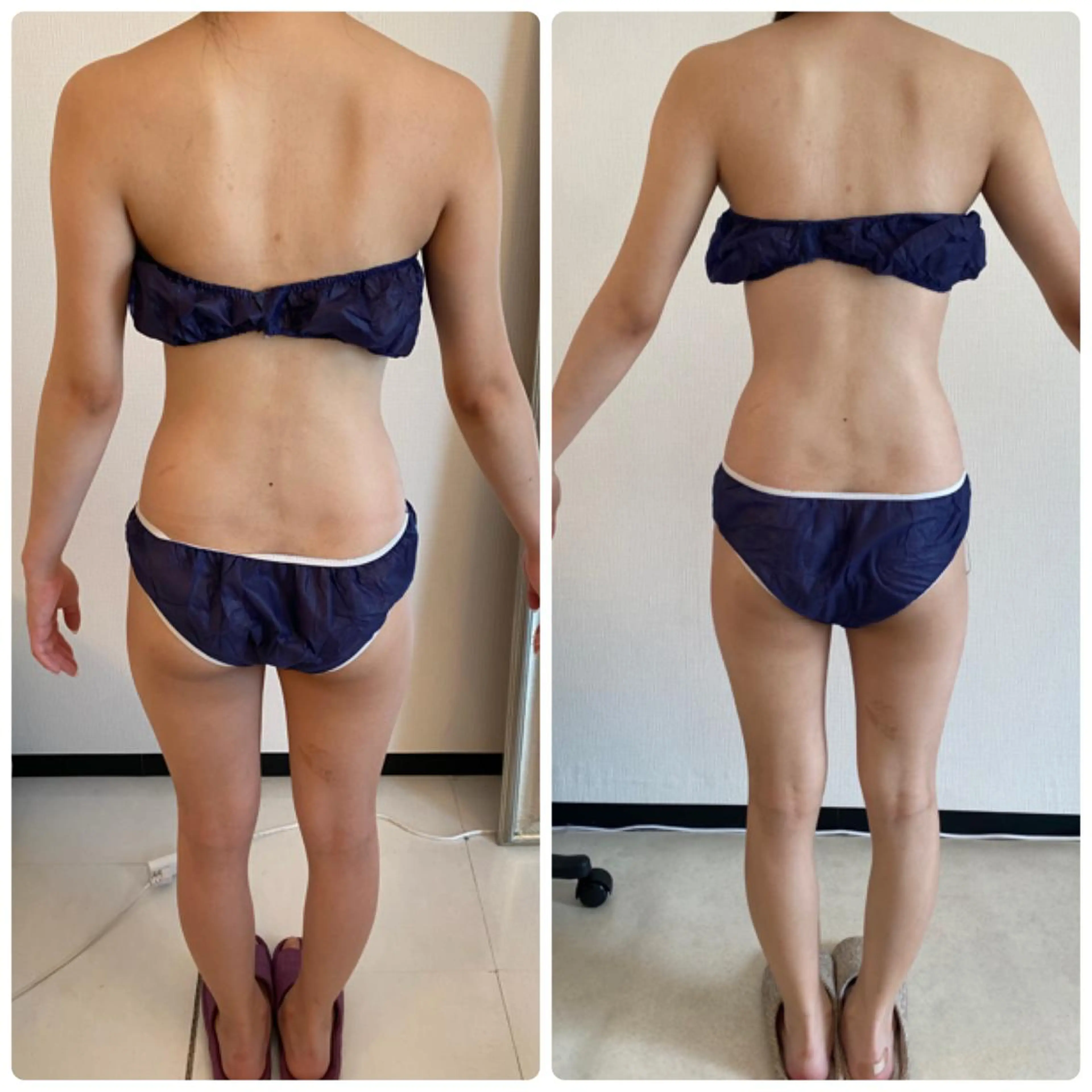 FLEUR大阪・整体 ・ハイフ・痩身・小顔のエステ・リラクイメージ