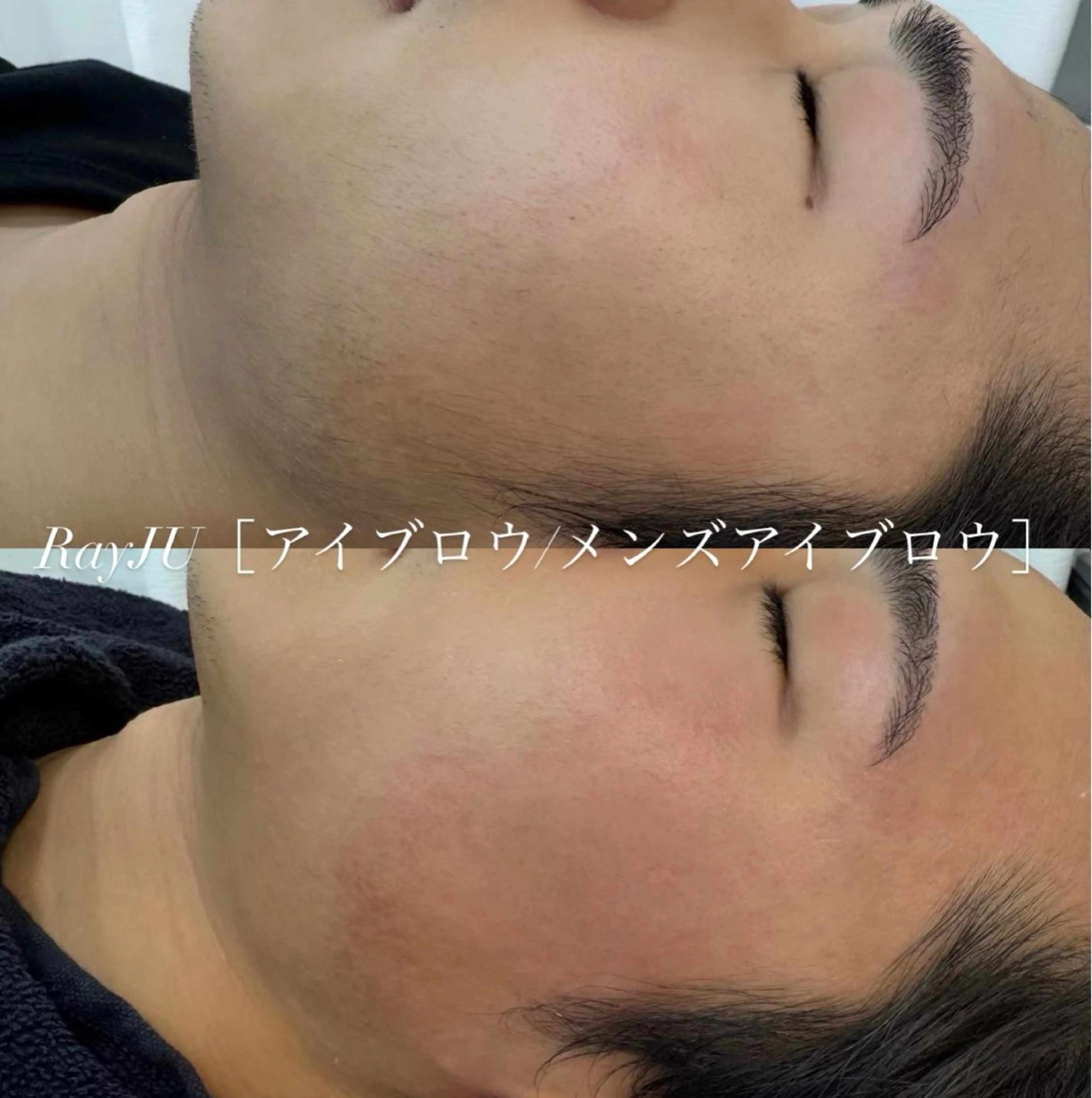 🚺🚹フルフェイスブラジリアンWAXのみの写真