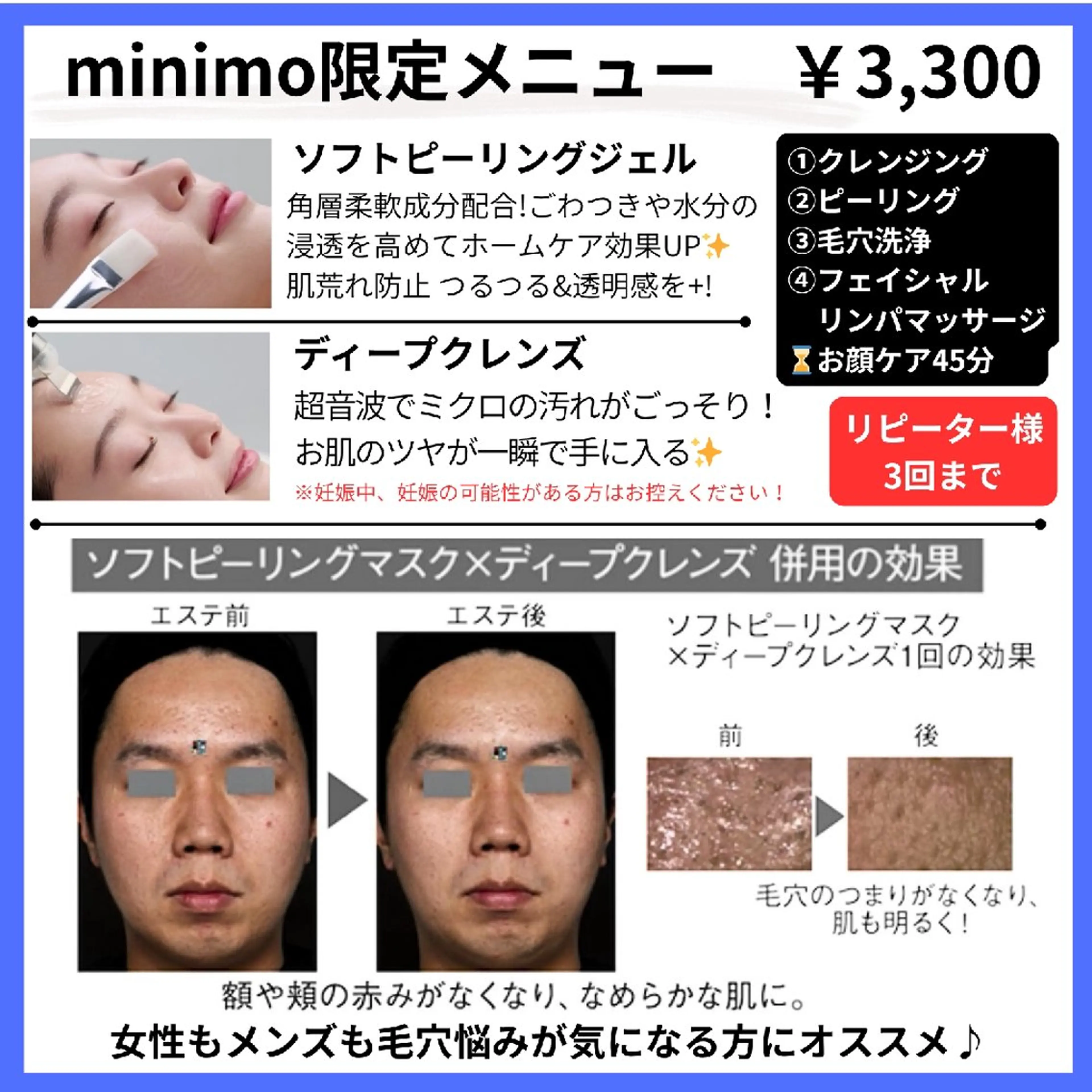 【毛穴汚れごっそりツルツル】ピーリング&毛穴洗浄モニターの写真