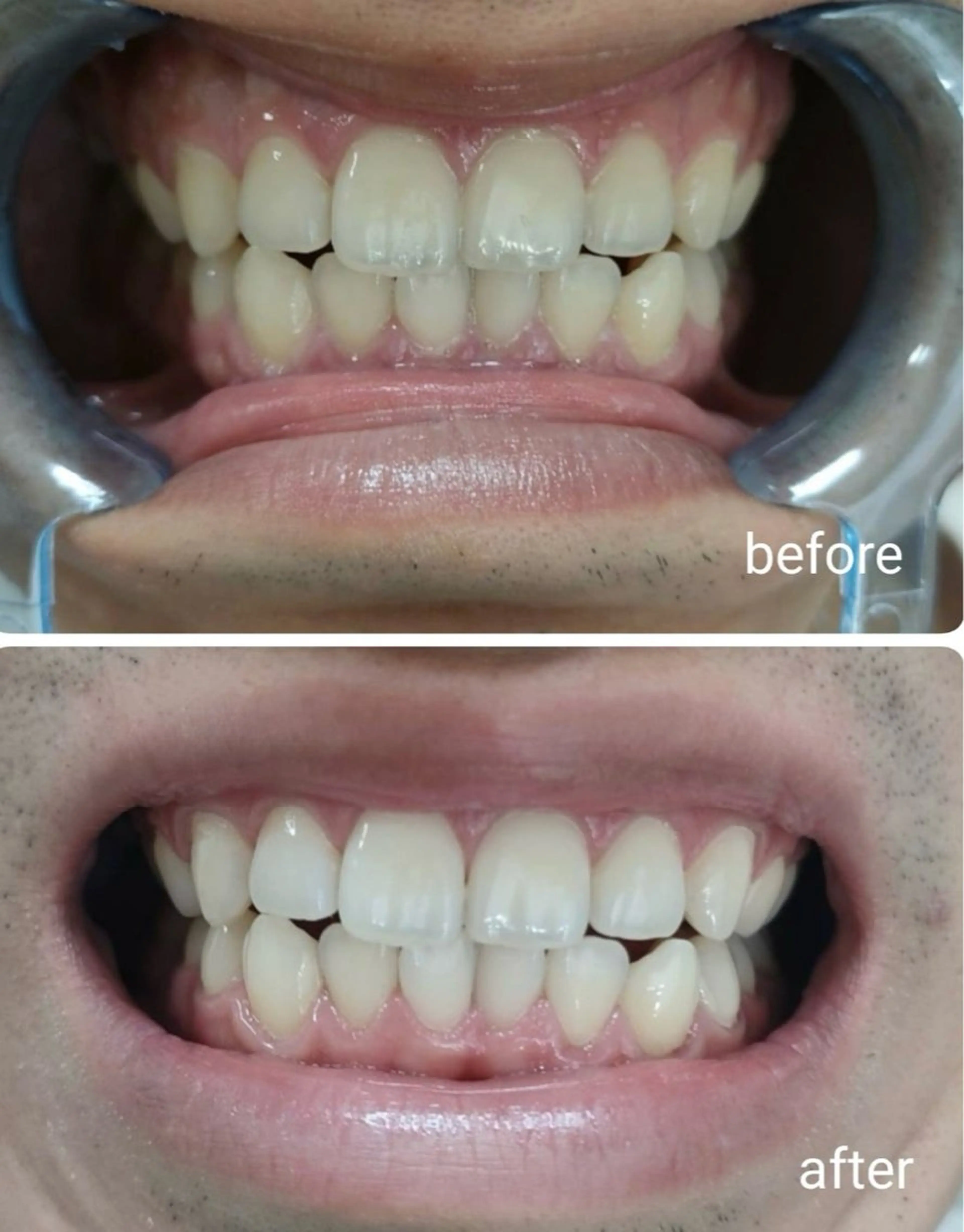 ecxia新宿西口店所属・セルフホワイトニング エクシア新宿西口店のその他イメージ