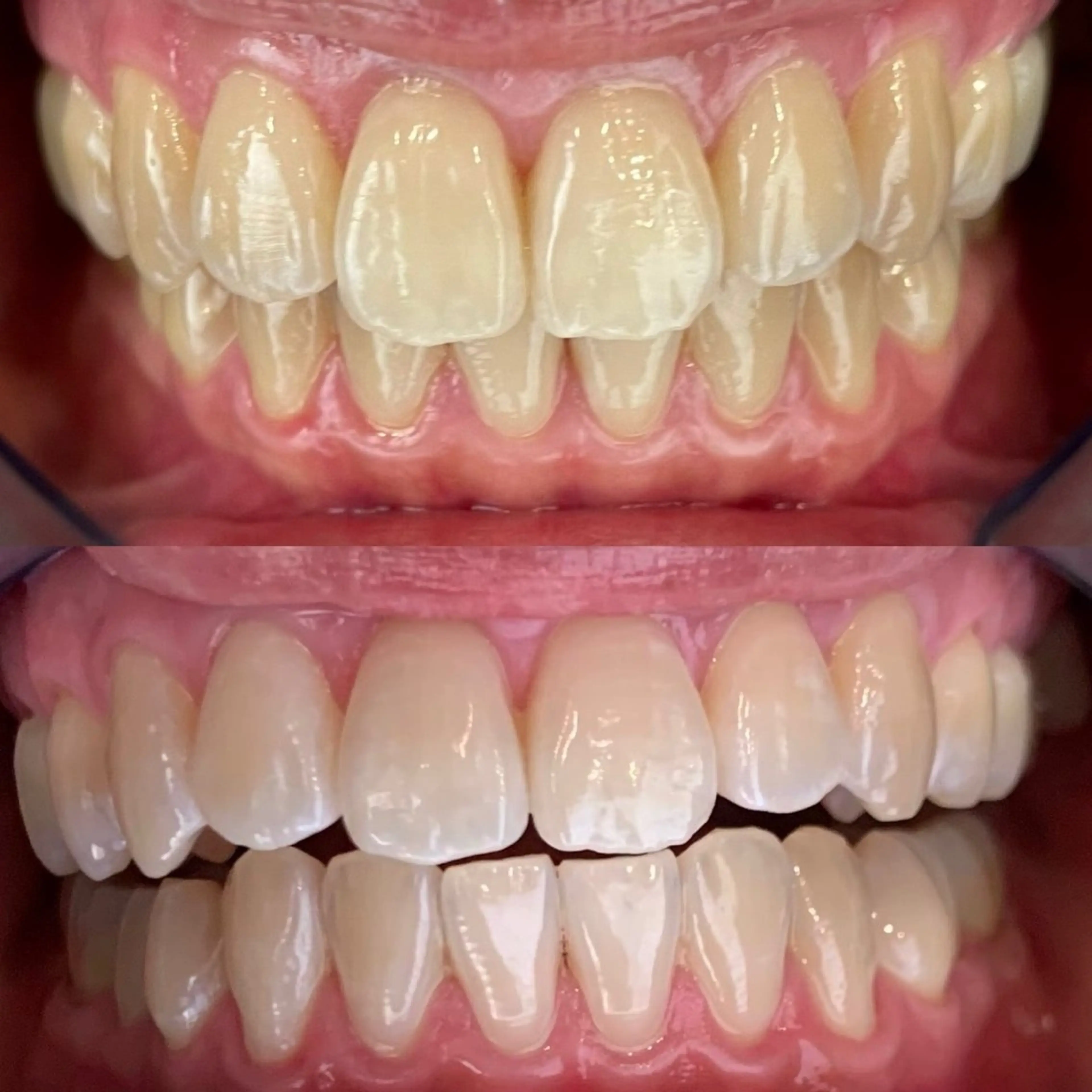 ホワイトニングサロンaile所属・セルフホワイトニング 金城しおりのその他イメージ