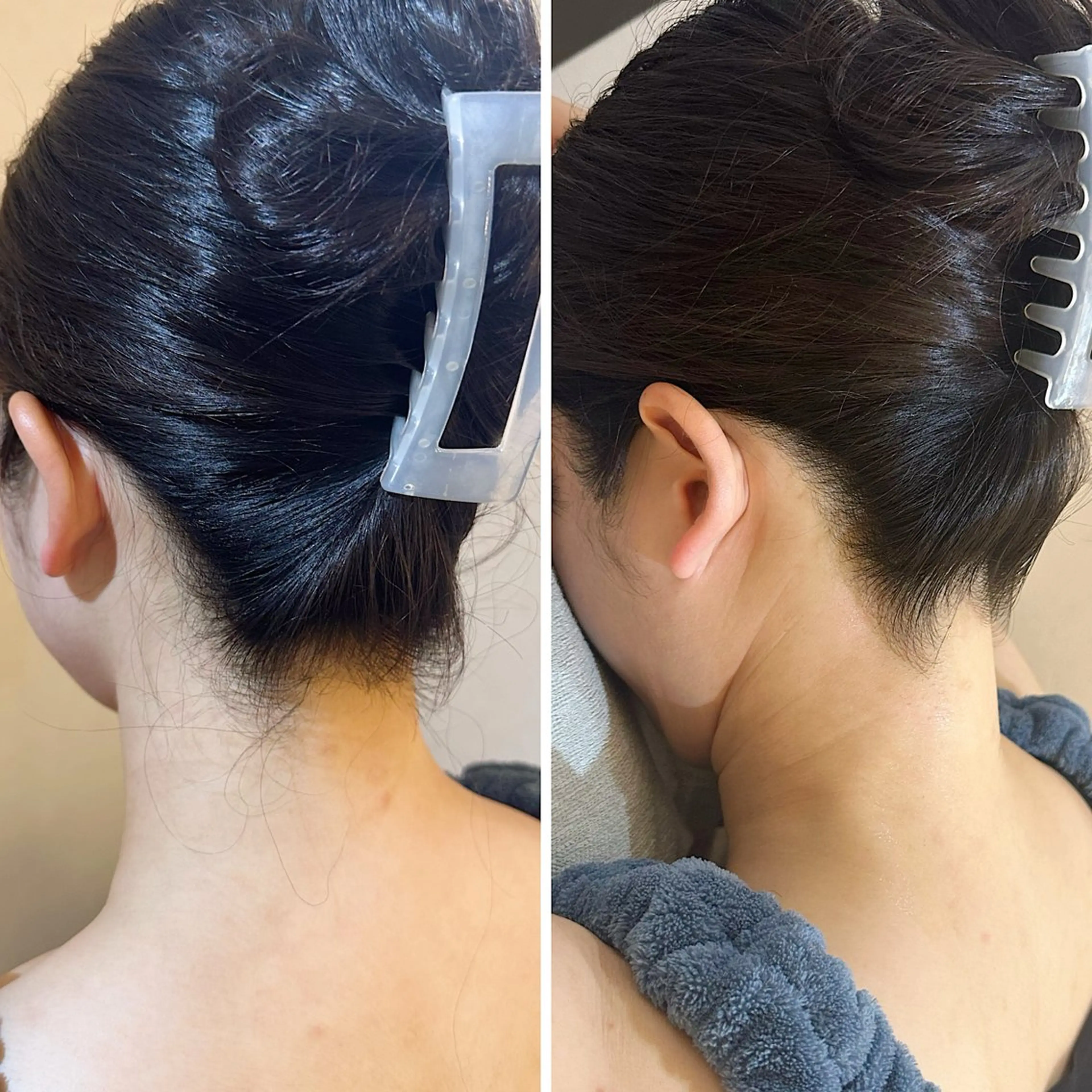 脱毛 うなじ脱毛/美肌脱毛 LABELのエステ・リラクイメージ