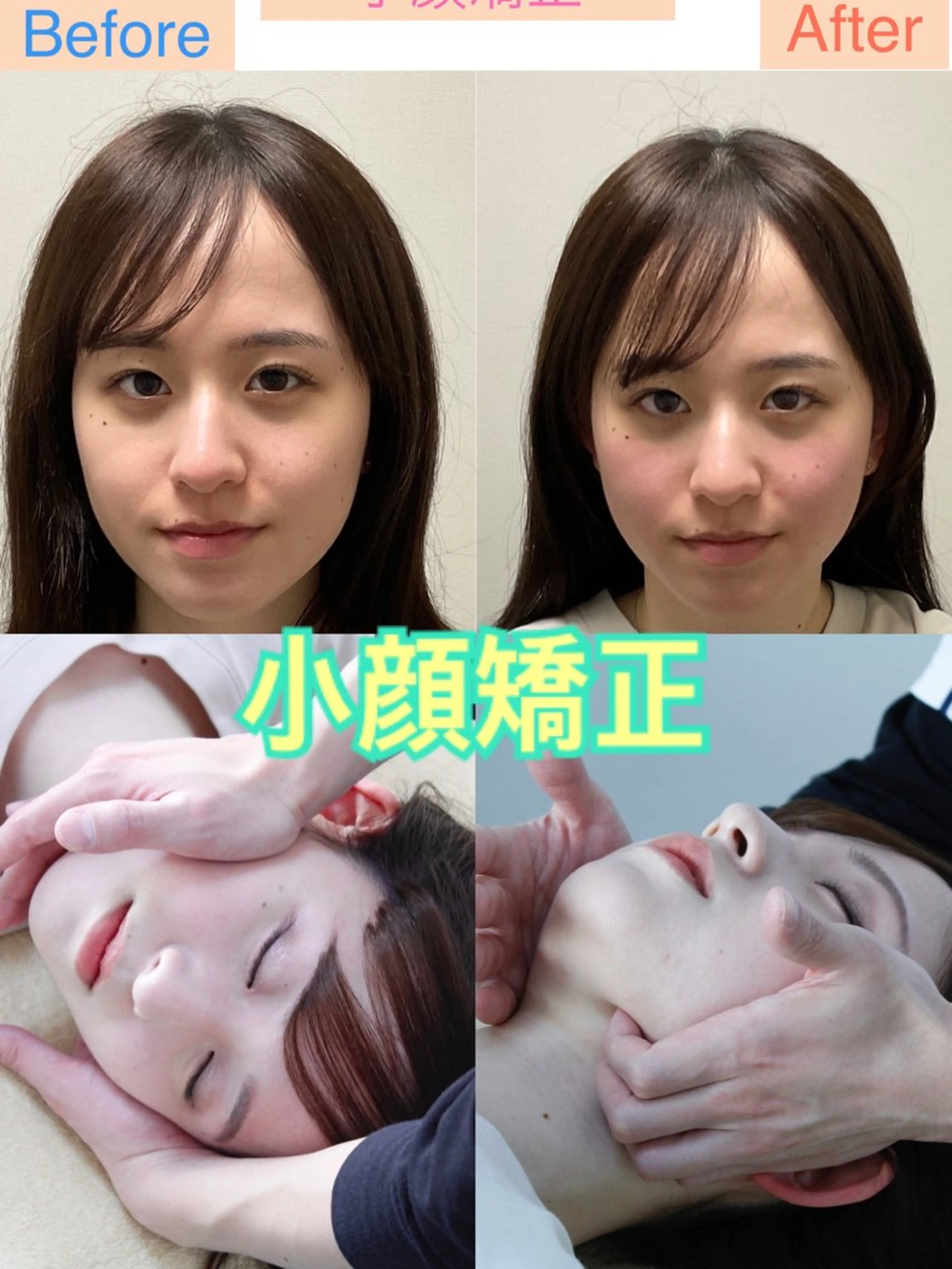 小顔矯正＋頭蓋骨矯正ブライダルその他(sns投稿が可能な方)小顔＋頭蓋骨矯正1回30分¥3000/２回目も¥3000の写真
