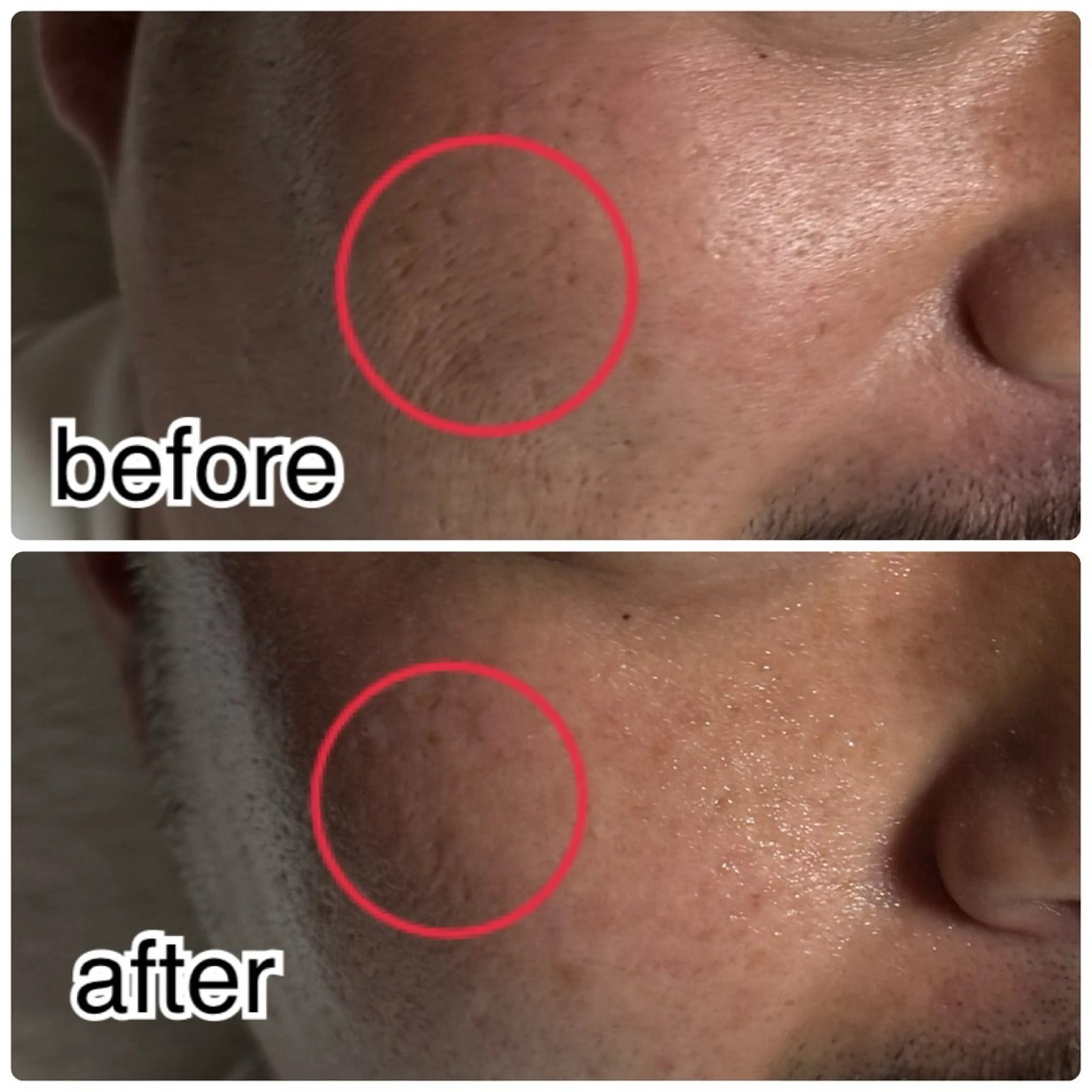 エステ ROR Akariのエステ・リラクイメージ