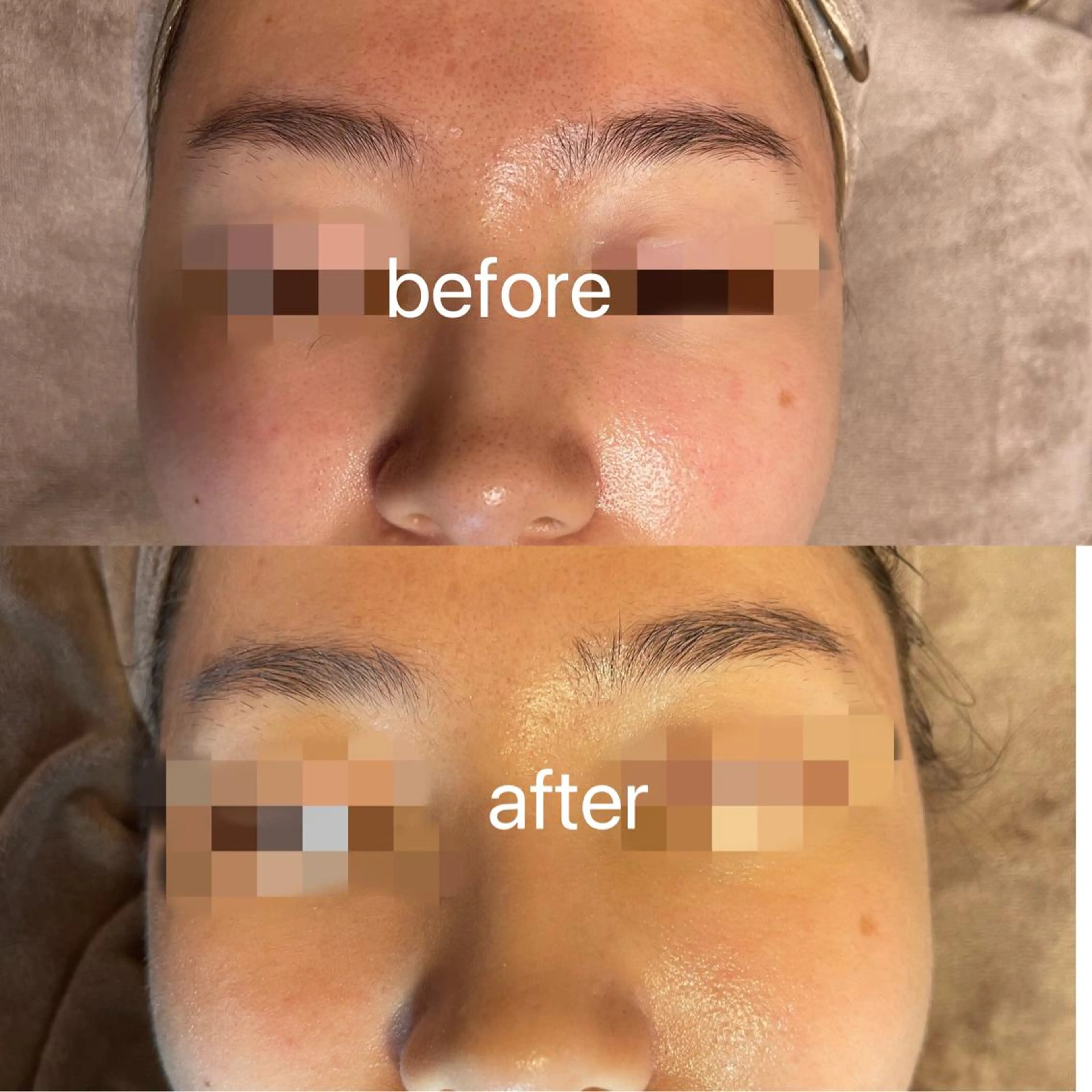 Einami 美肌痩身サロンのエステ・リラクイメージ