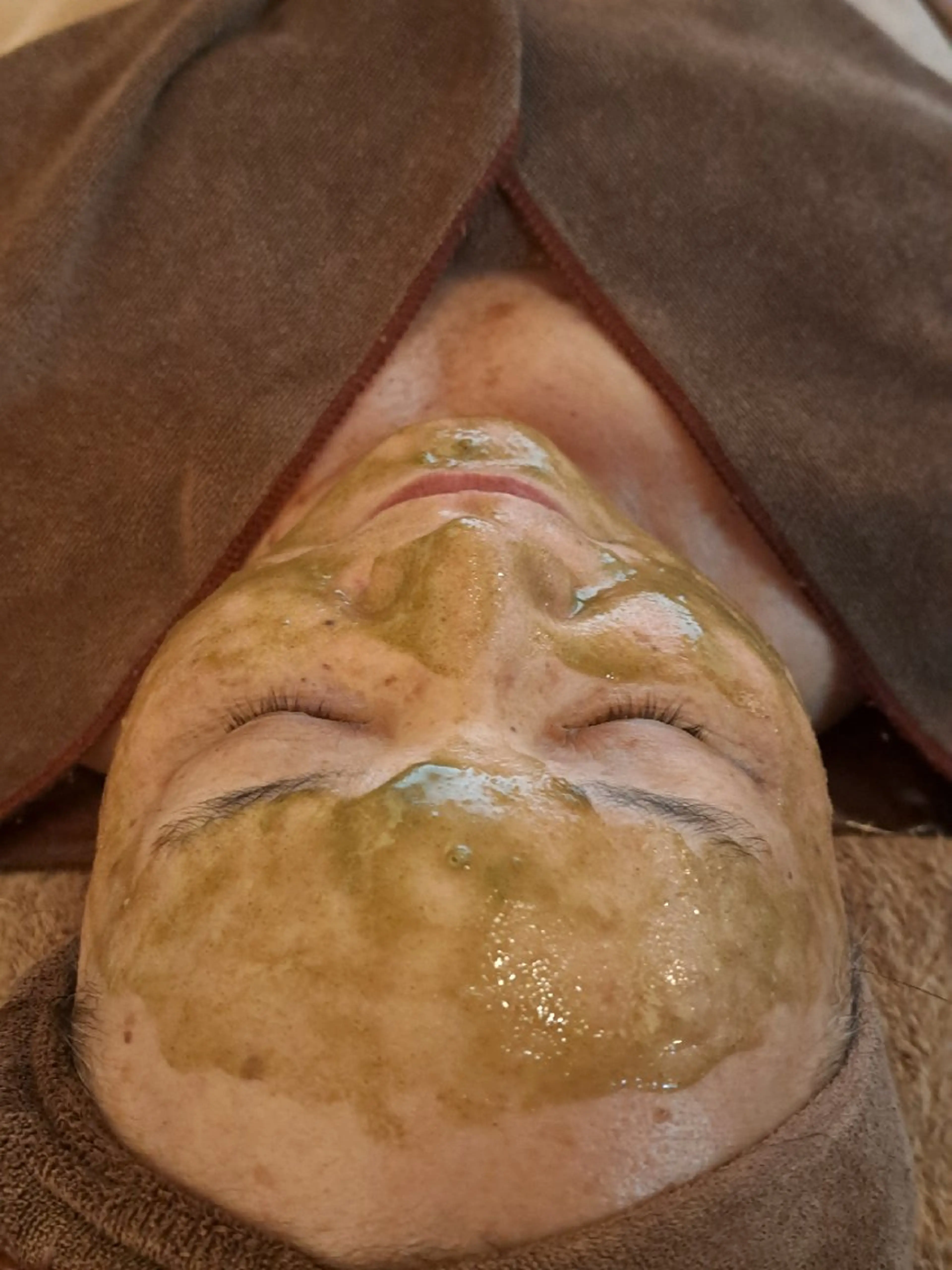 【美容鍼×ハーブピーリング🌿】ハリ艶肌✨引き締め小顔フェイシャル💆デコルテ首肩リンパ付】の写真