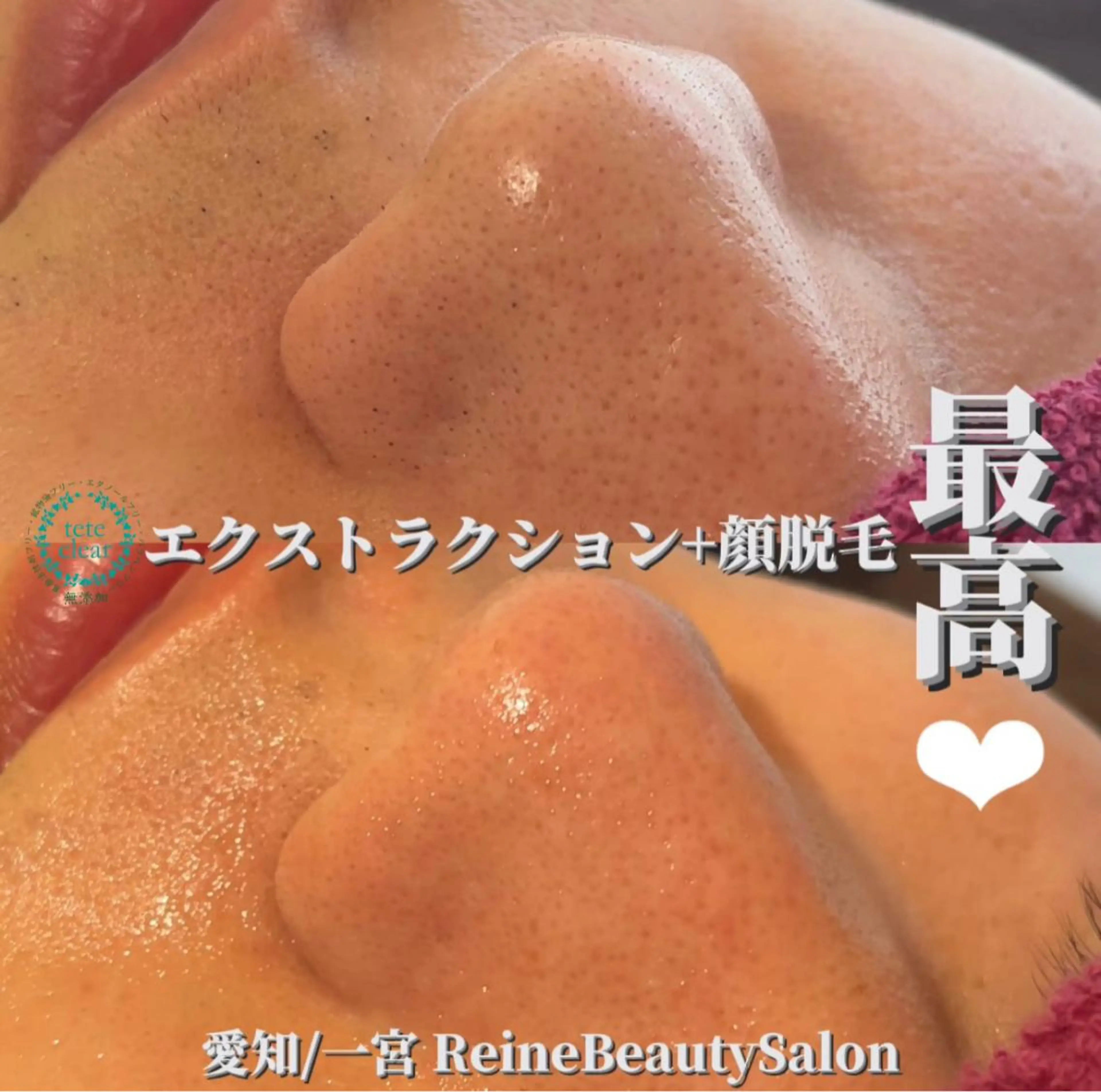 エステ Reine BeautySalon所属・毛穴/シミ肝斑/脱毛 横山梨里のエステ・リラクイメージ