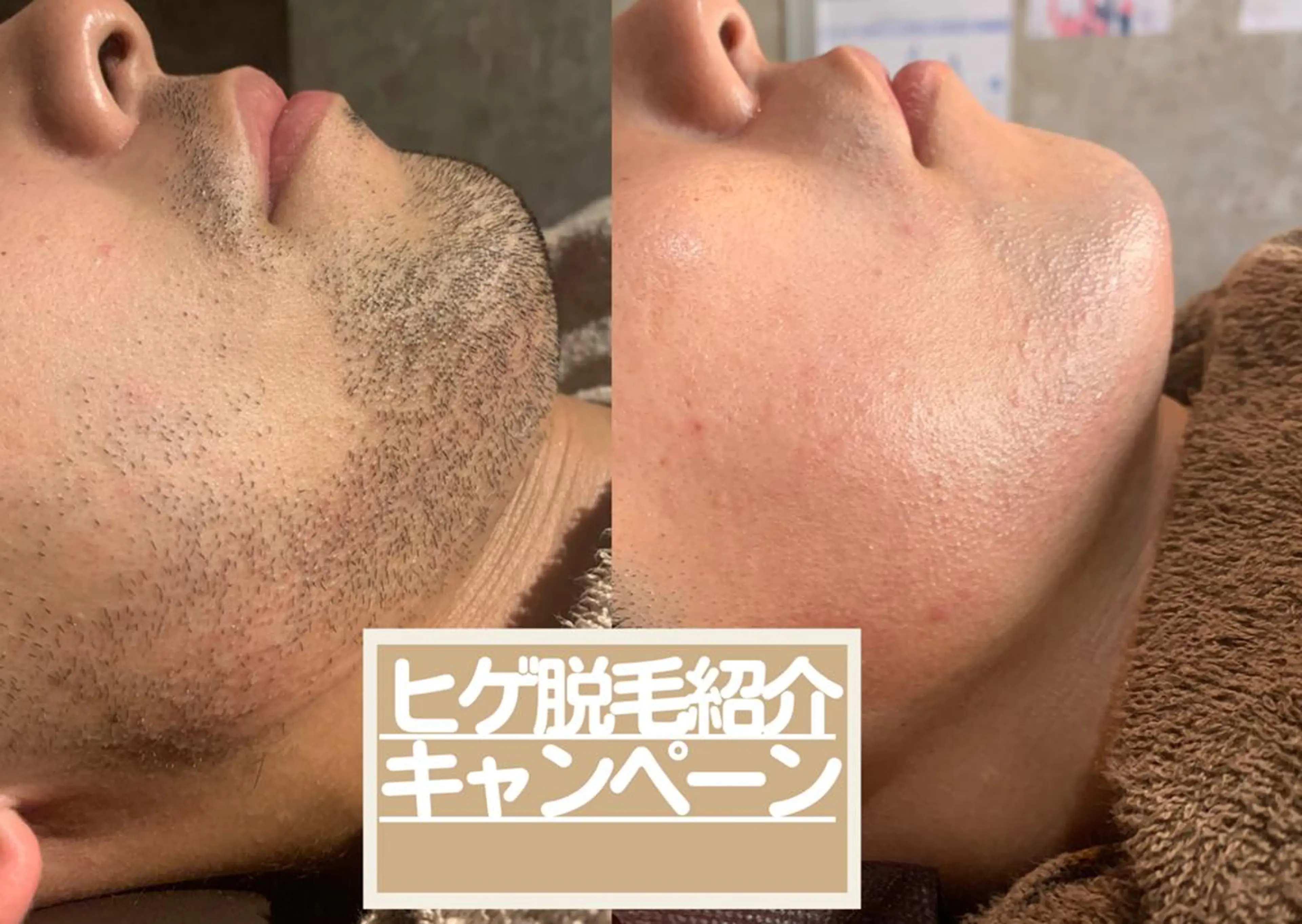 メンズ 20代から始める脱毛 salonLEPIAのエステ・リラクイメージ