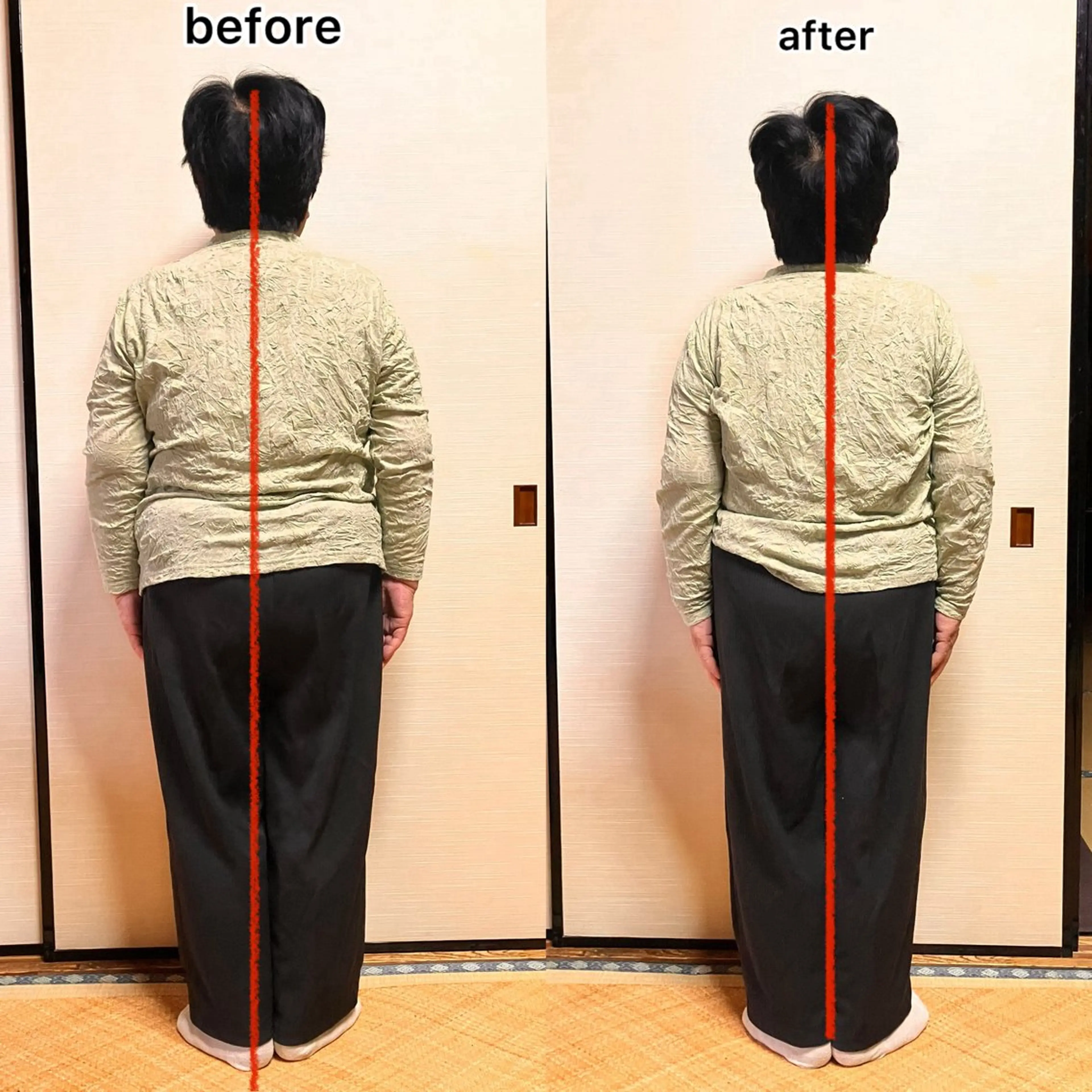 姿勢改善ストレッチの写真