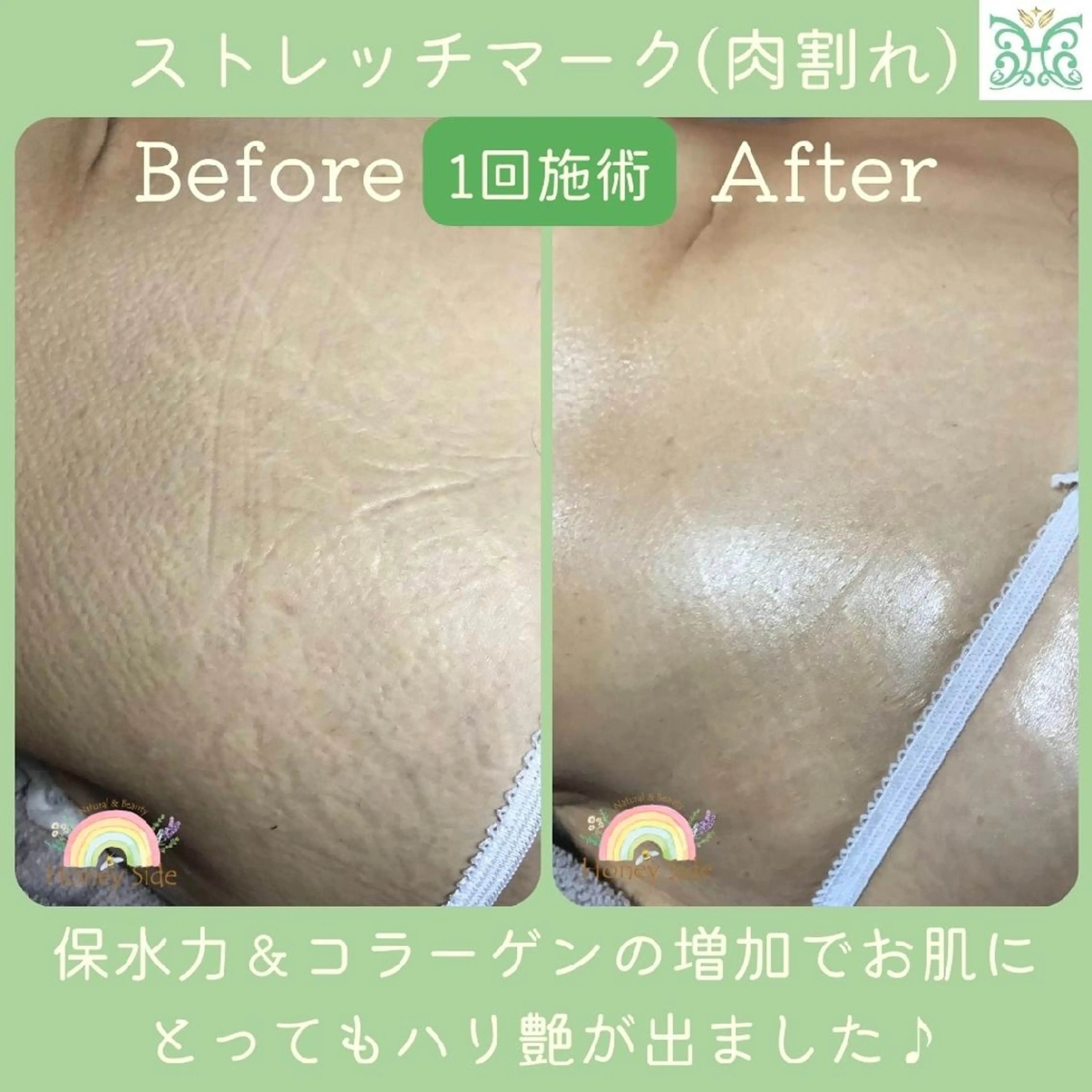 エステ 剥離するハーブ🌈 Honey Sideのエステ・リラクイメージ