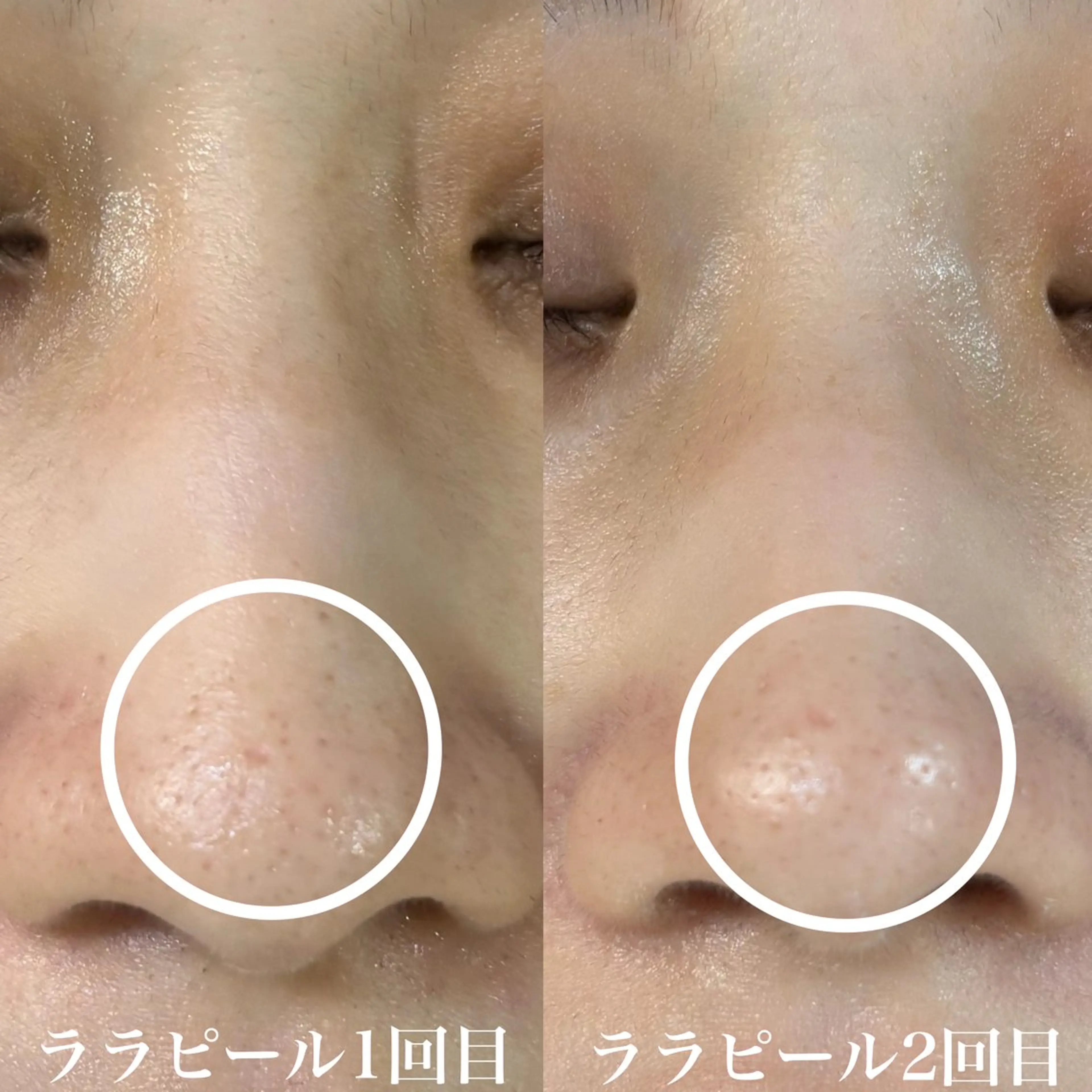 エステ WHITE AQUA 北千住店のエステ・リラクイメージ