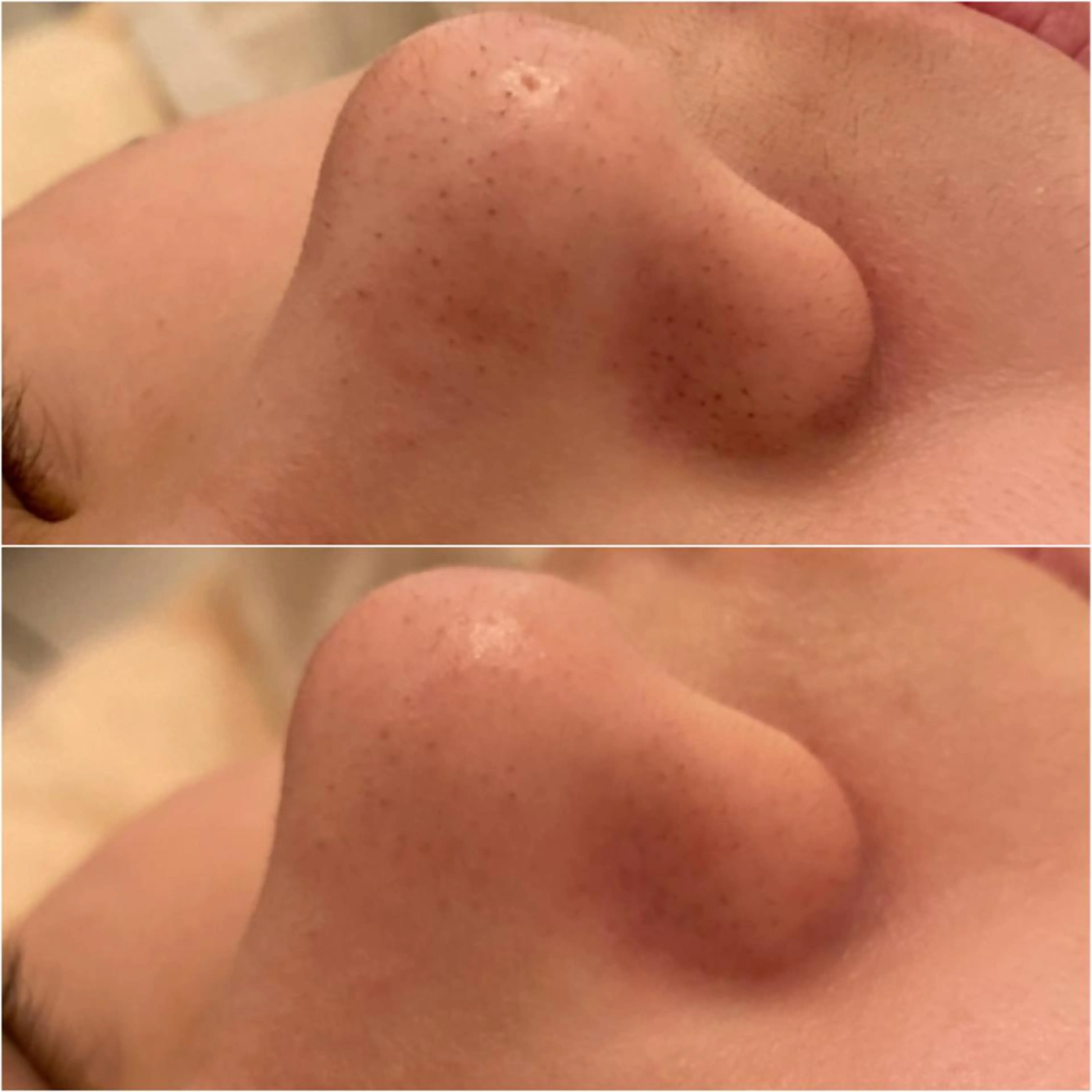 エステ ✨美肌水光✨ アトリエリュバンのエステ・リラクイメージ