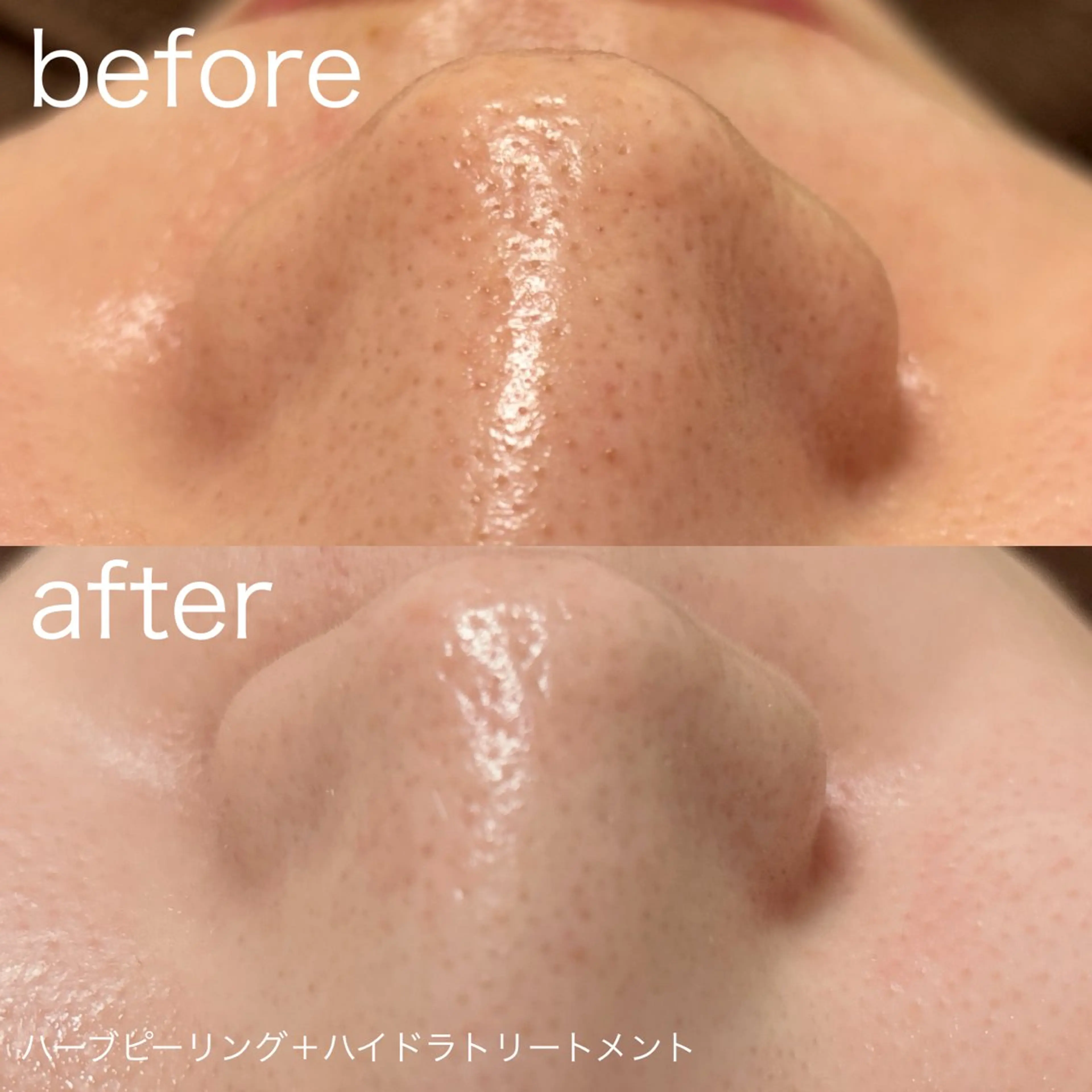脱毛 lulularico Yu🫧のエステ・リラクイメージ