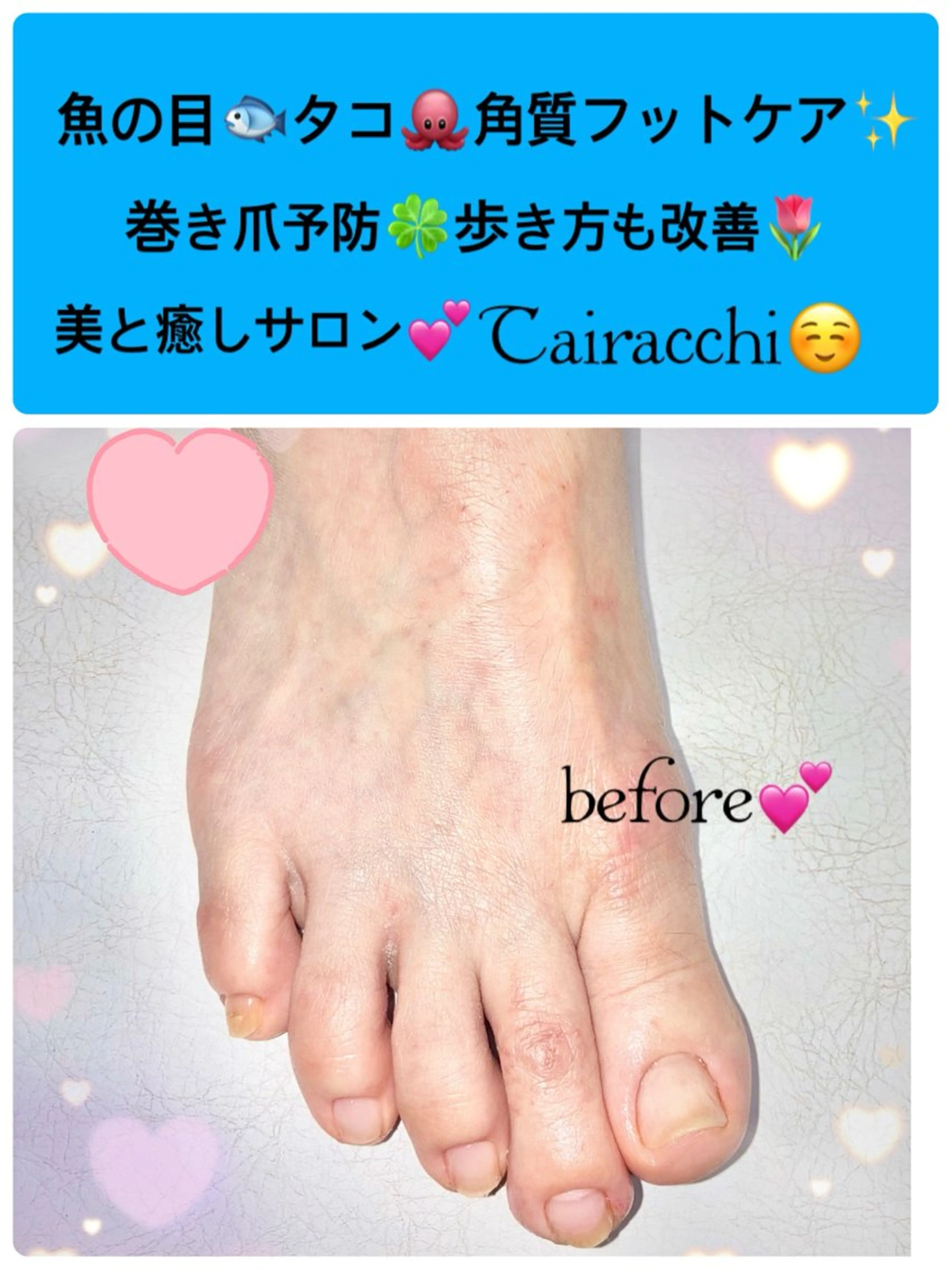 ネイル フットネイル フットネイル Tairacchi ﾀｲﾗｯﾁのエステ・リラクイメージ