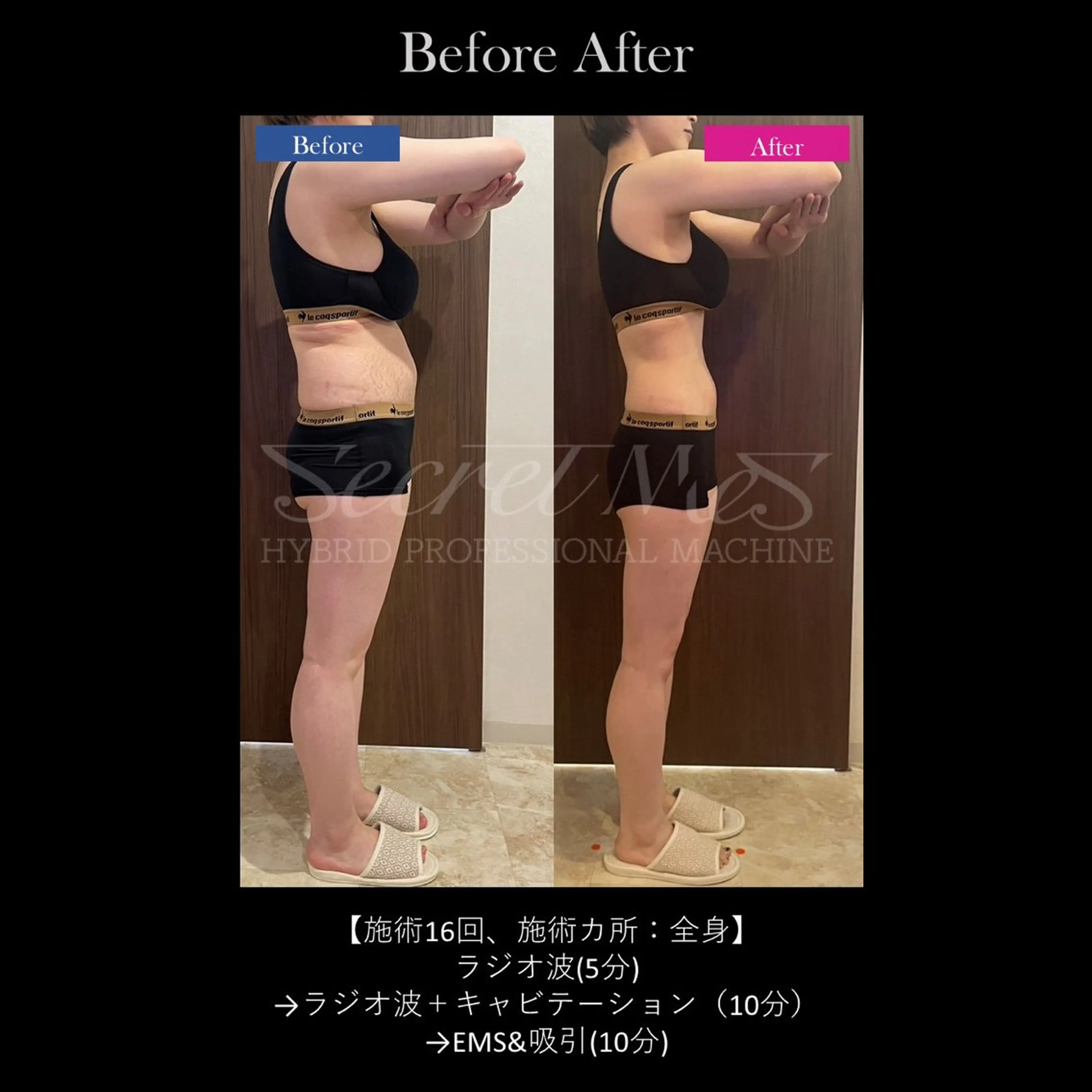 エステ Bellvie beauty salon所属・Bellvie かすみのエステ・リラクイメージ